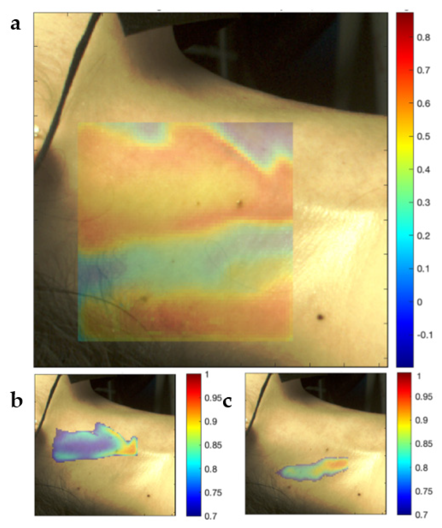 Sensors Free FullText Towards Development of Specular Reflection