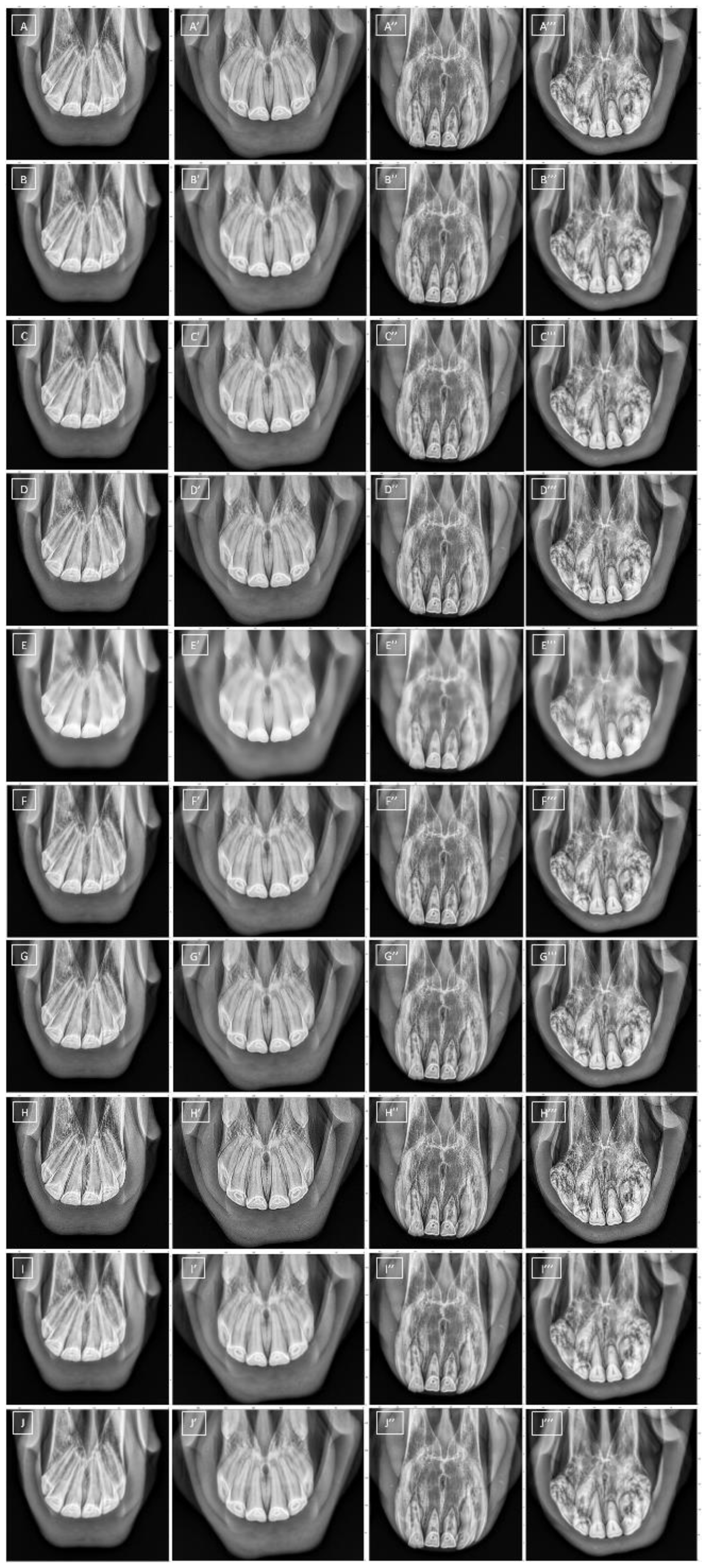 Sensors 22 02920 g002 550