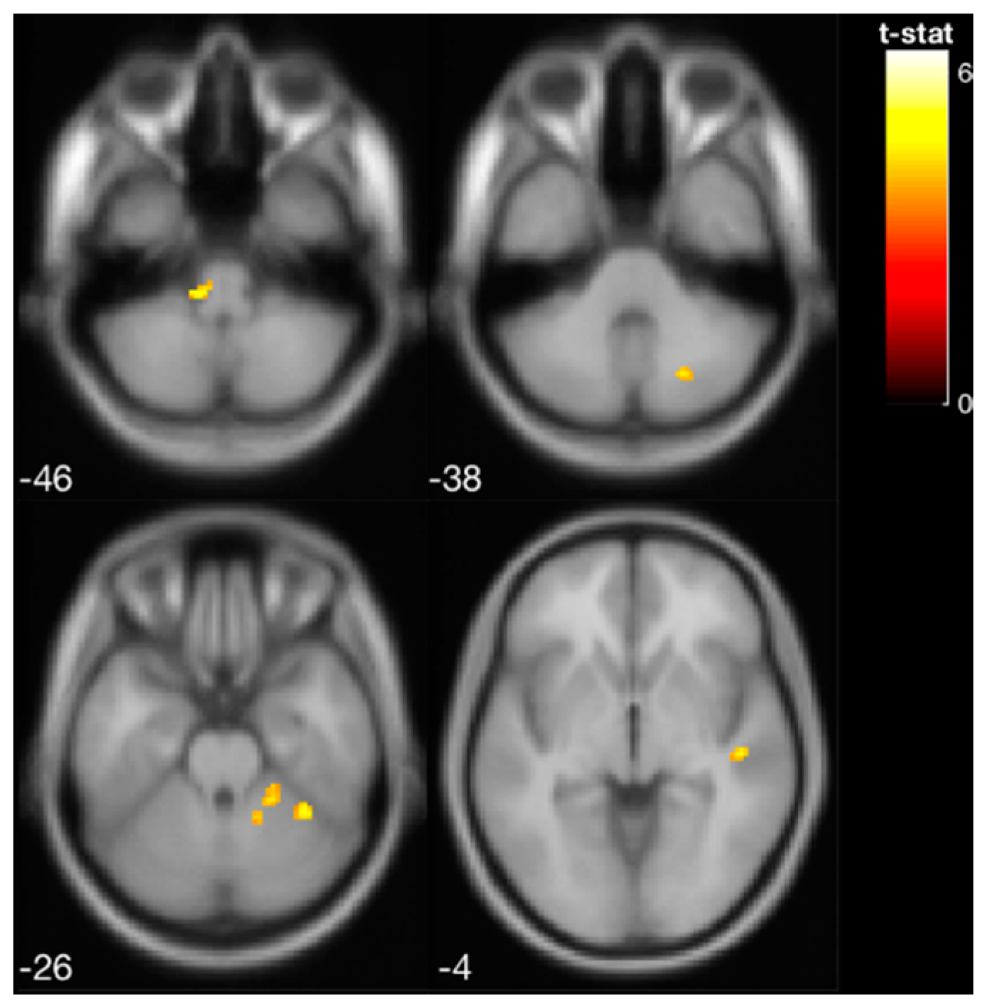 Sensors 22 03014 g004