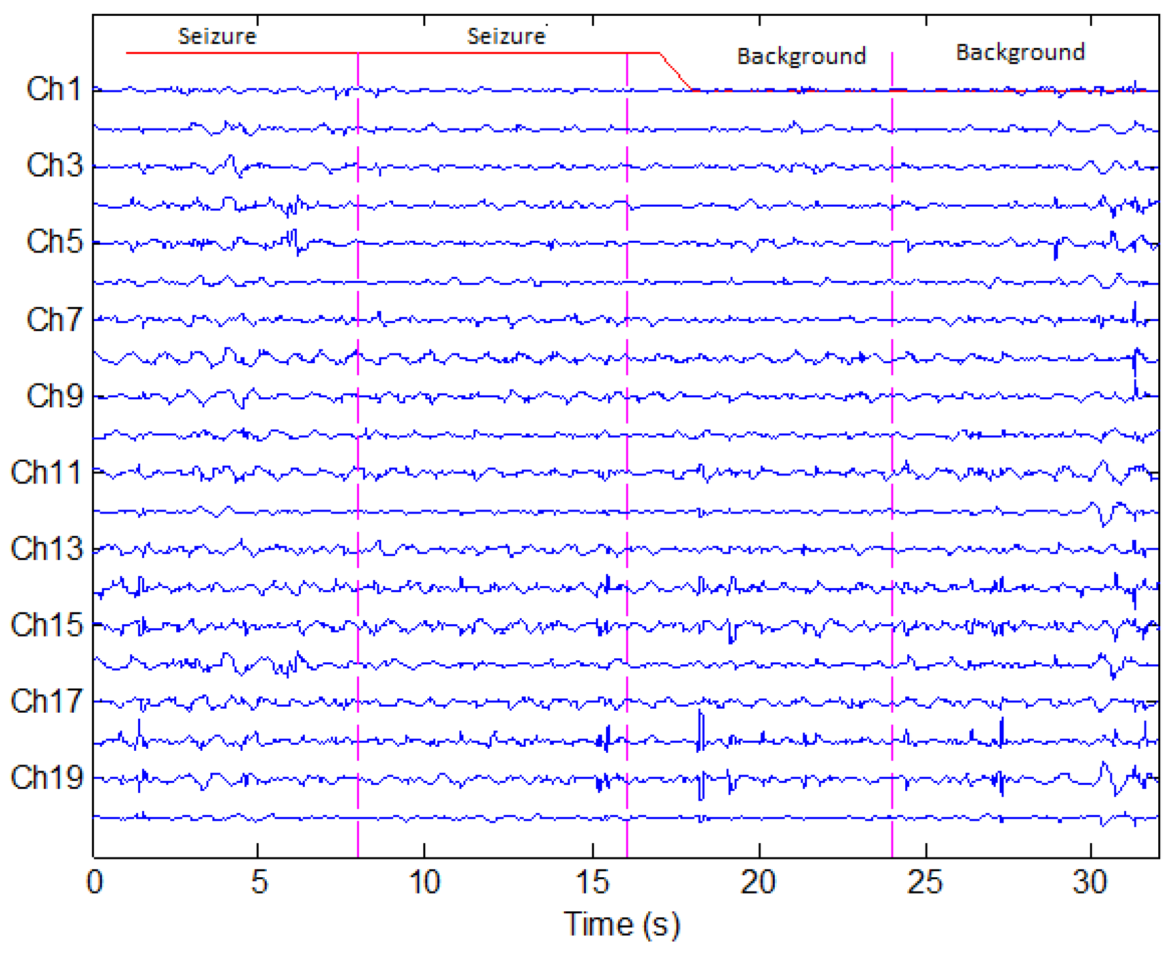 Sensors 22 03036 g006 550