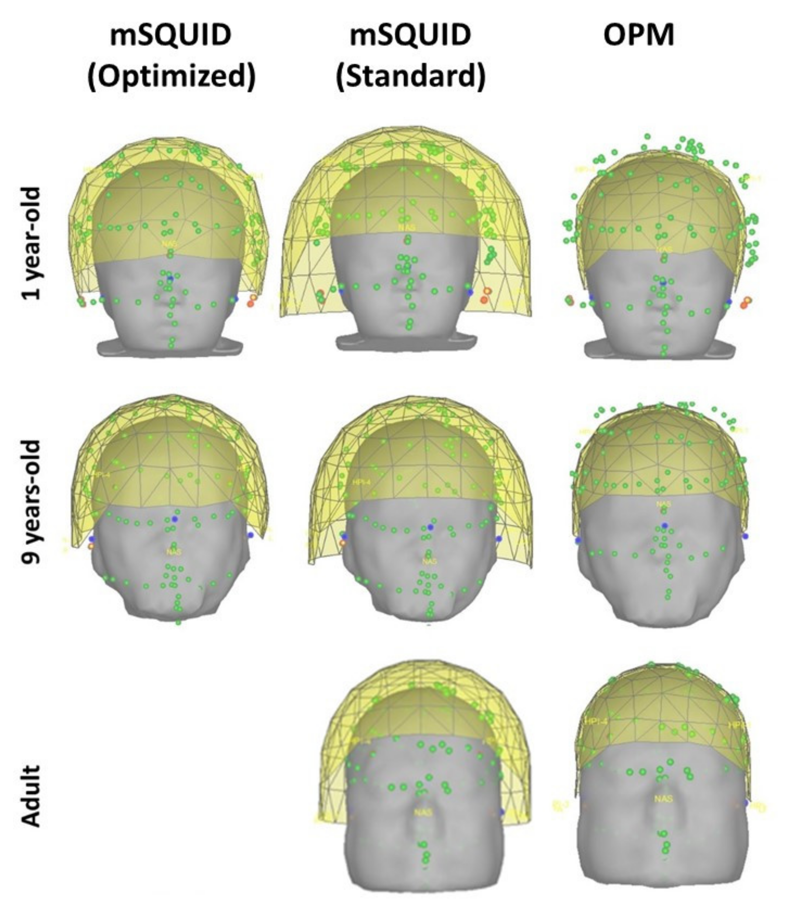 Sensors 22 03093 g001 550