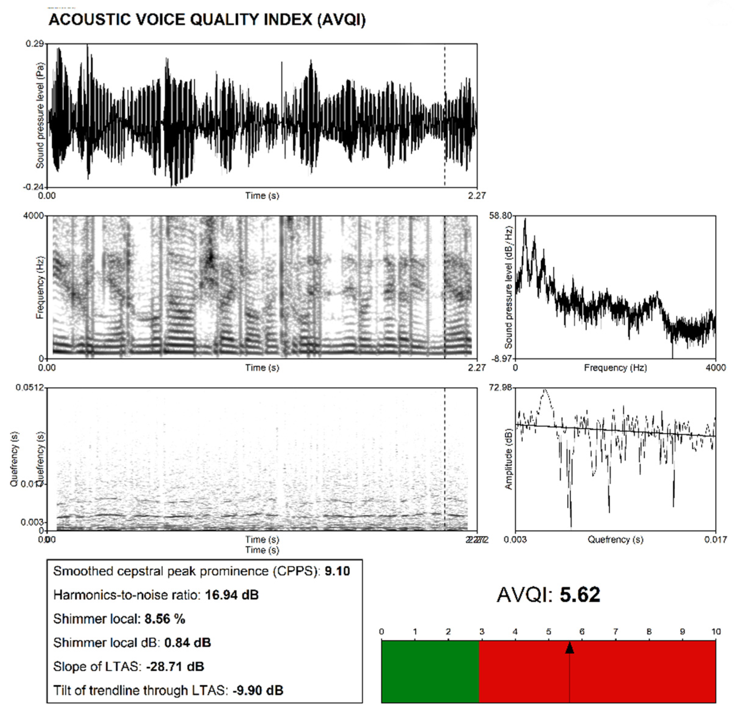 Sensors 22 03188 g005
