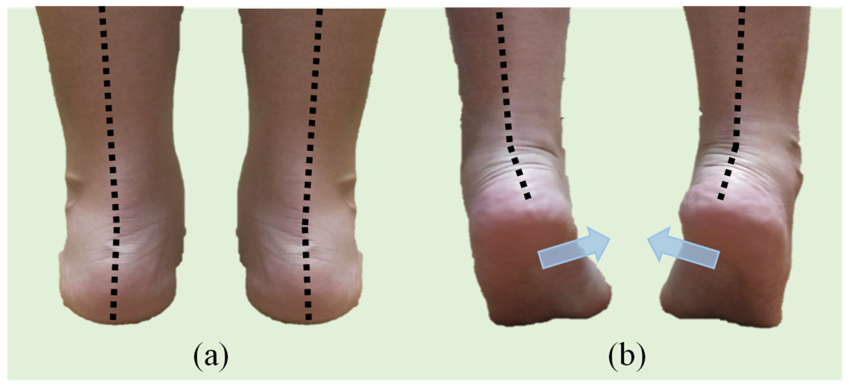 Sensors 22 03442 g002 550