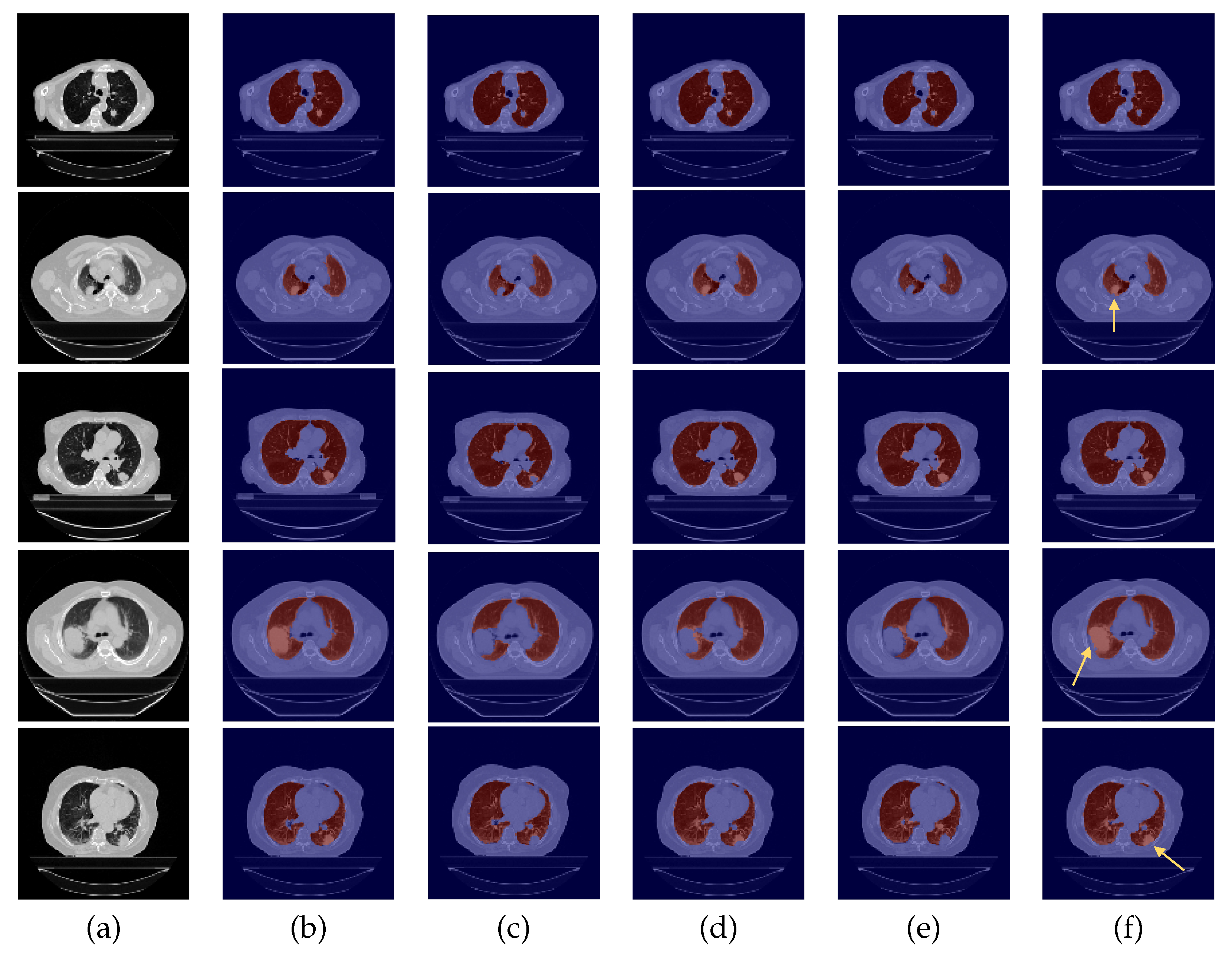 Sensors 22 03443 g005 550