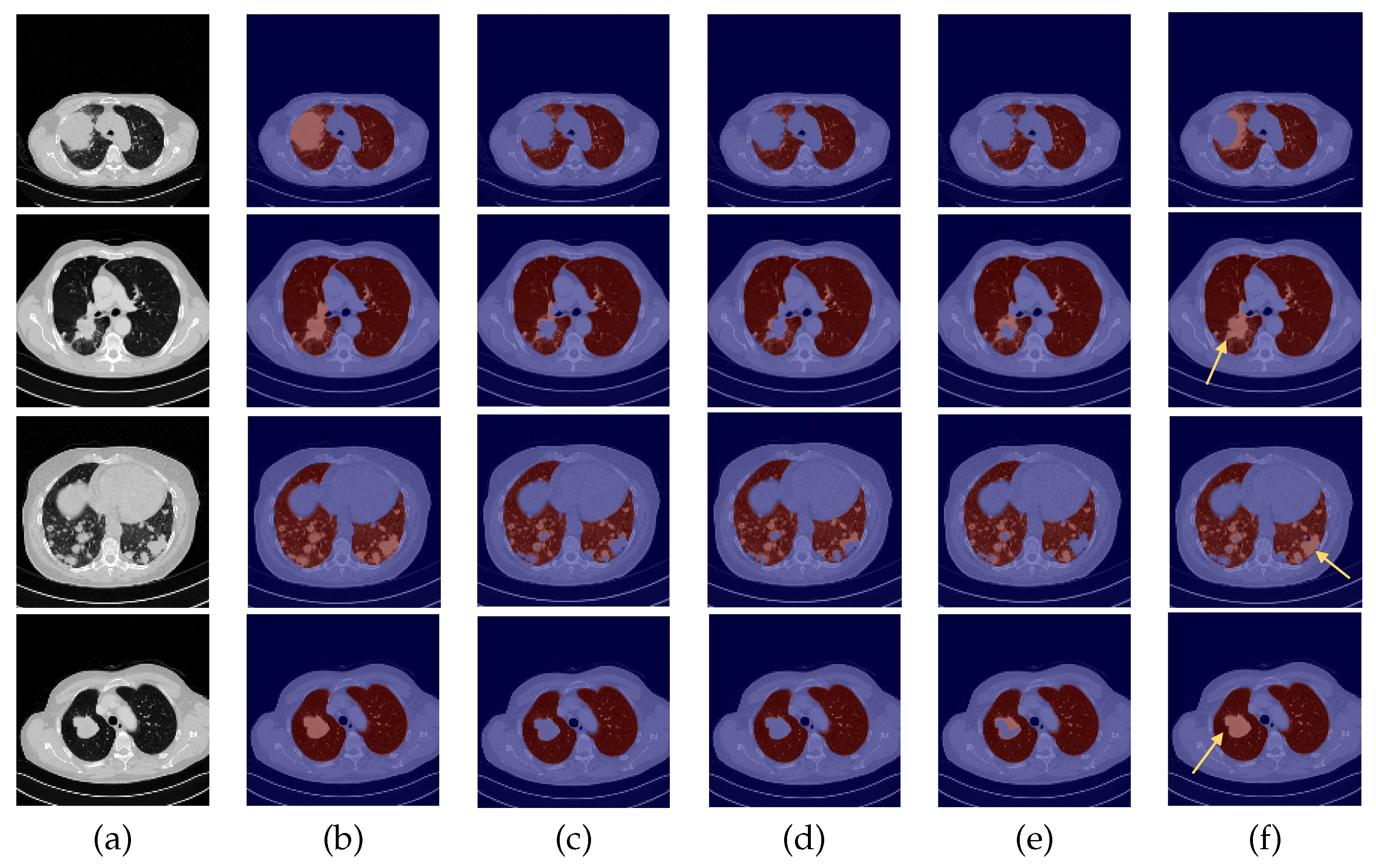 Sensors 22 03443 g006 550