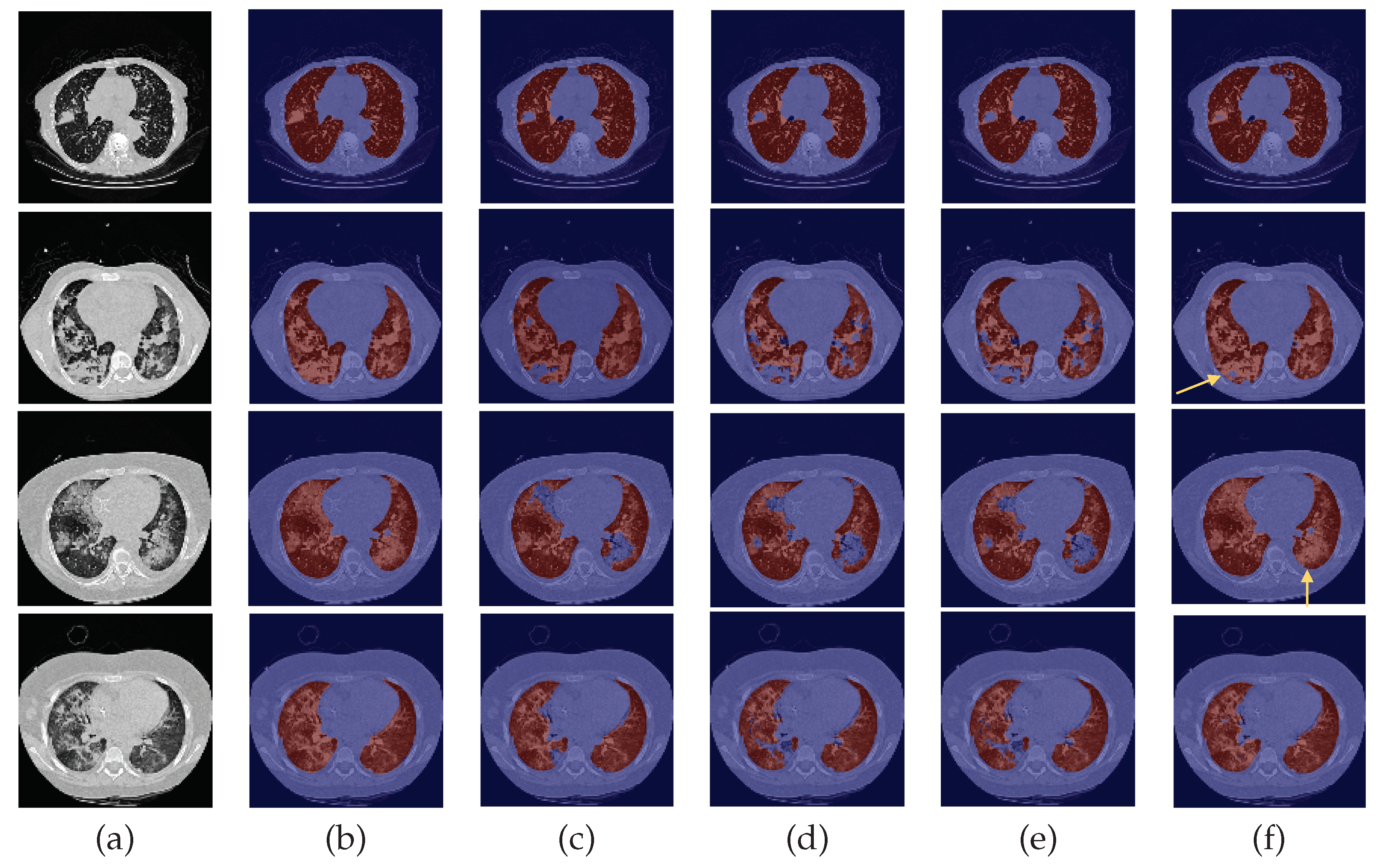 Sensors 22 03443 g007 550