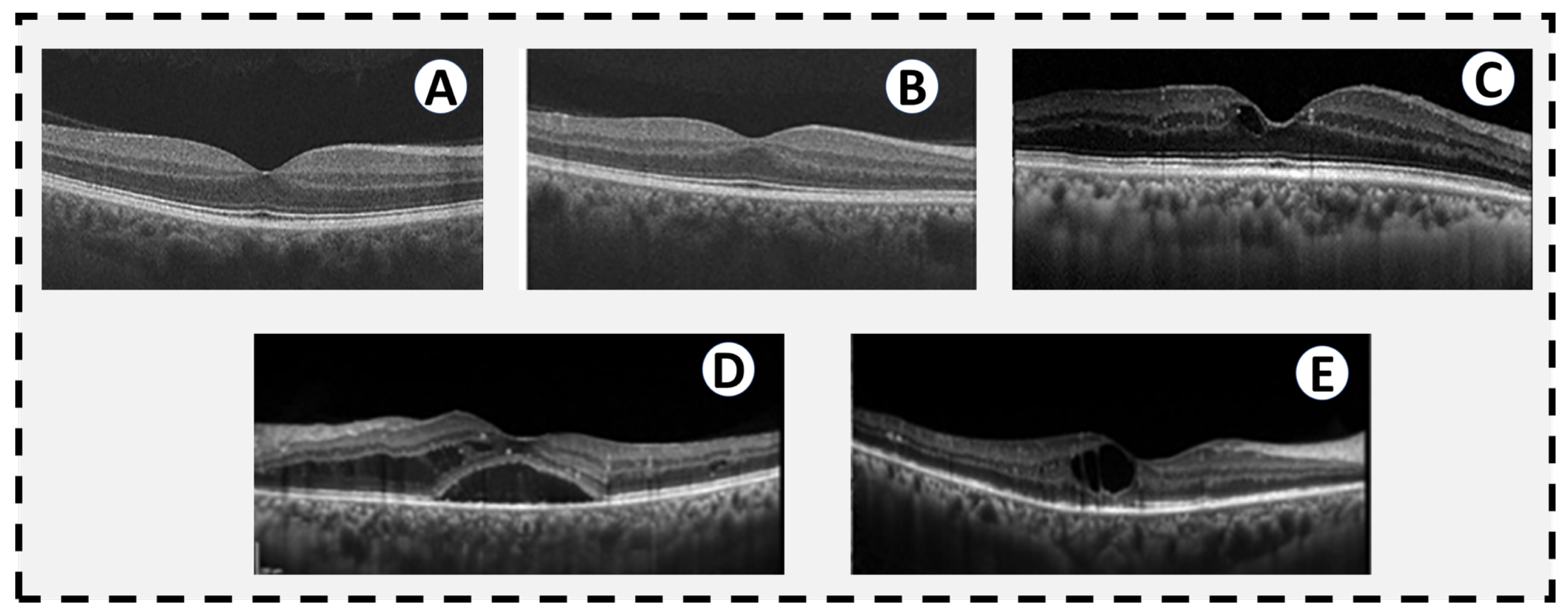 Sensors 22 03490 g003