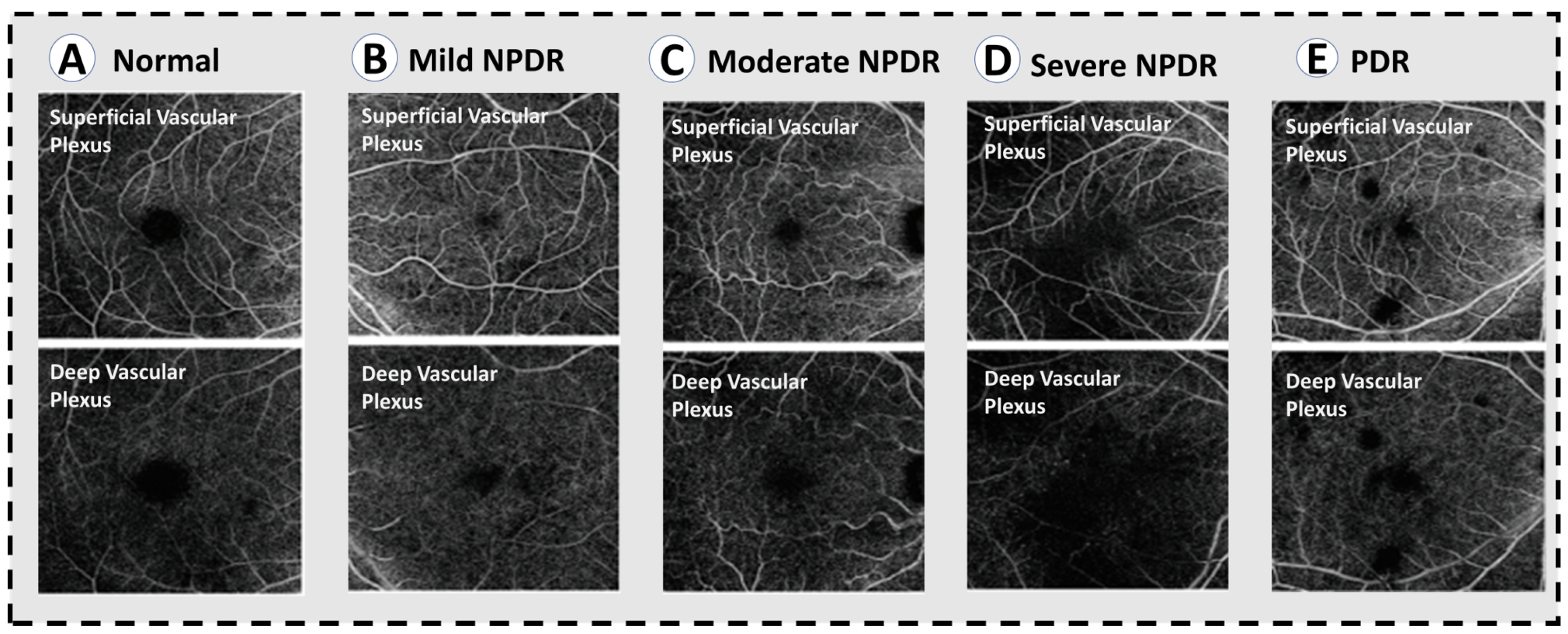 Sensors 22 03490 g004
