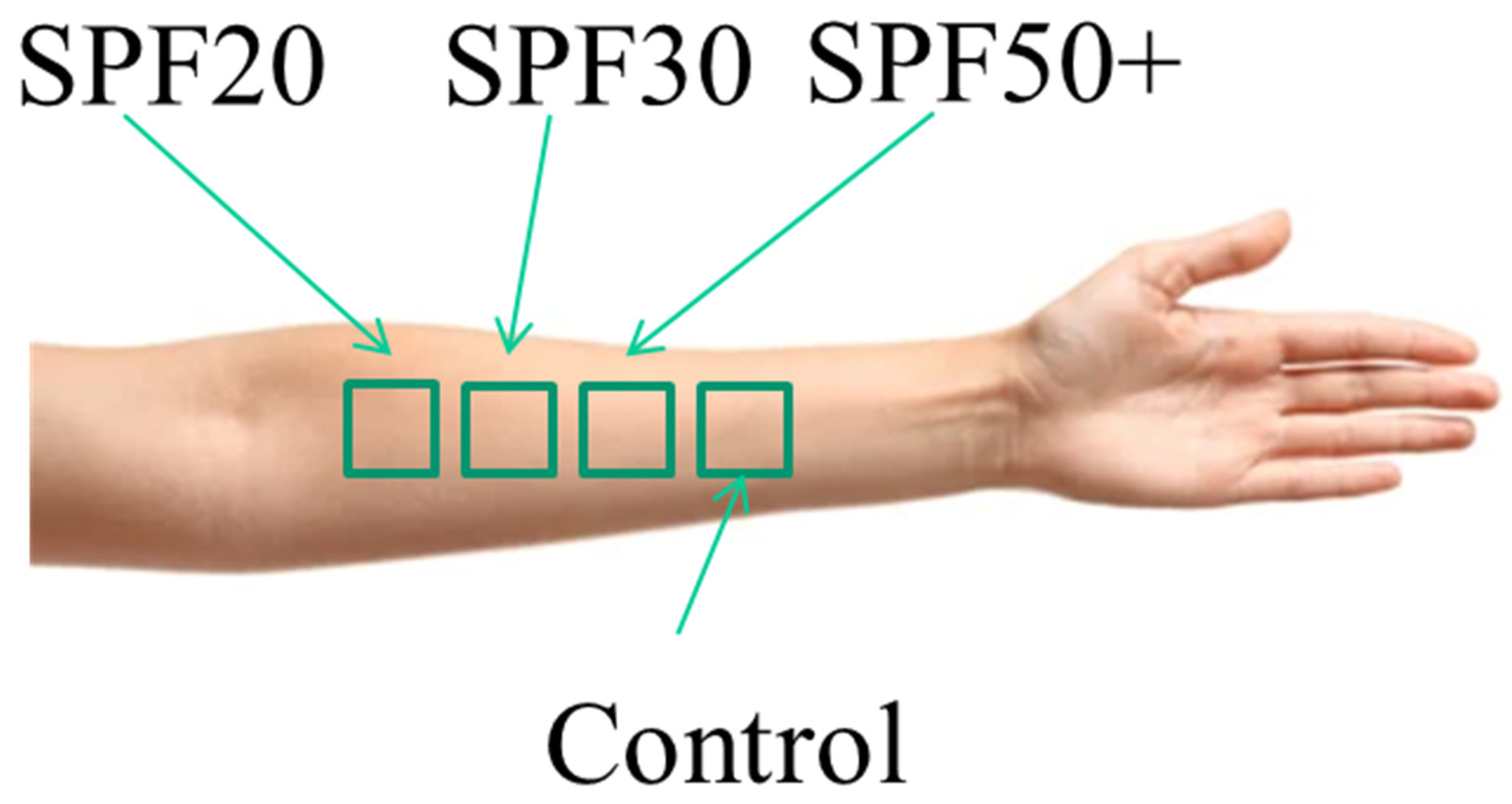 Sensors 22 03595 g002