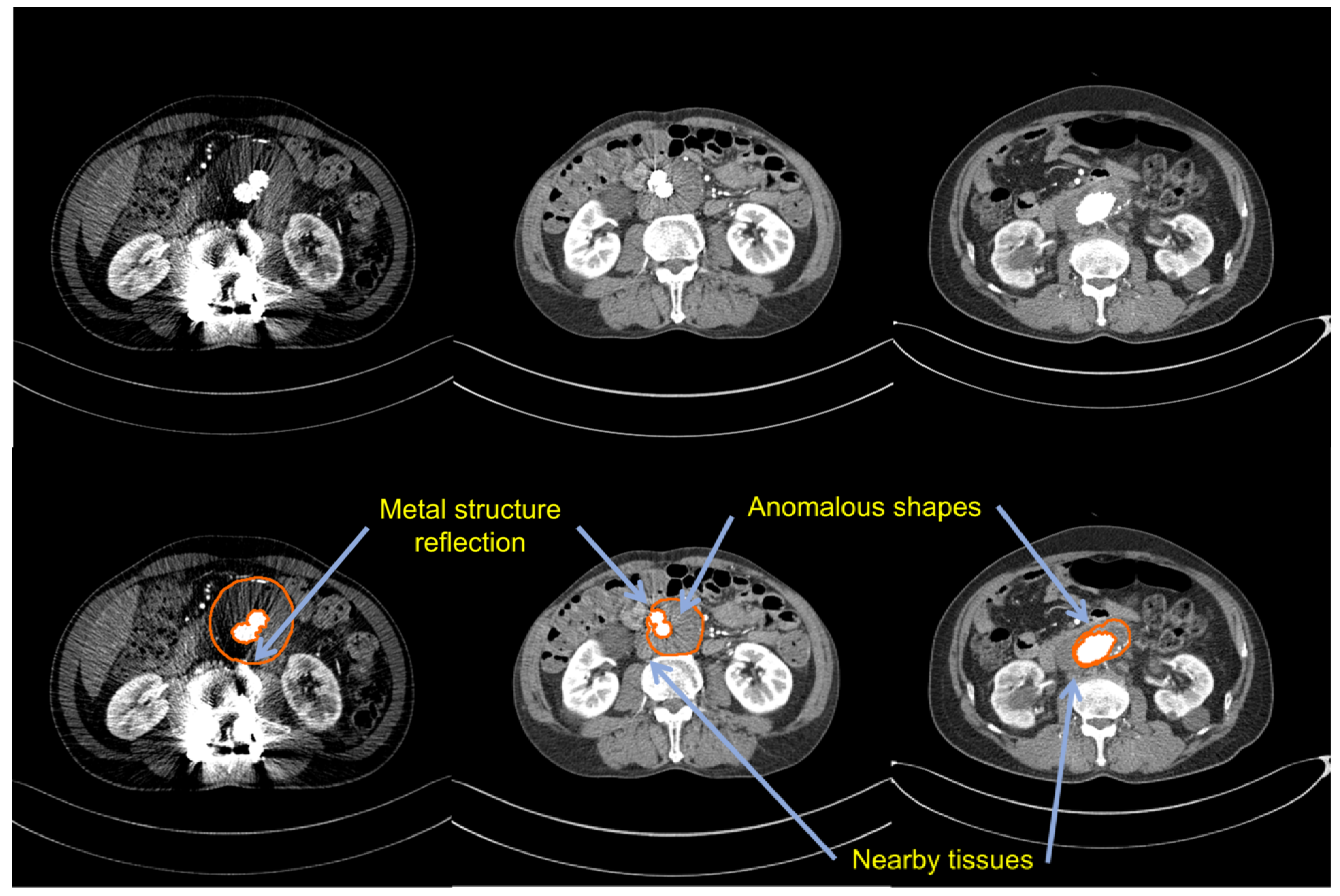Sensors 22 03643 g001 550