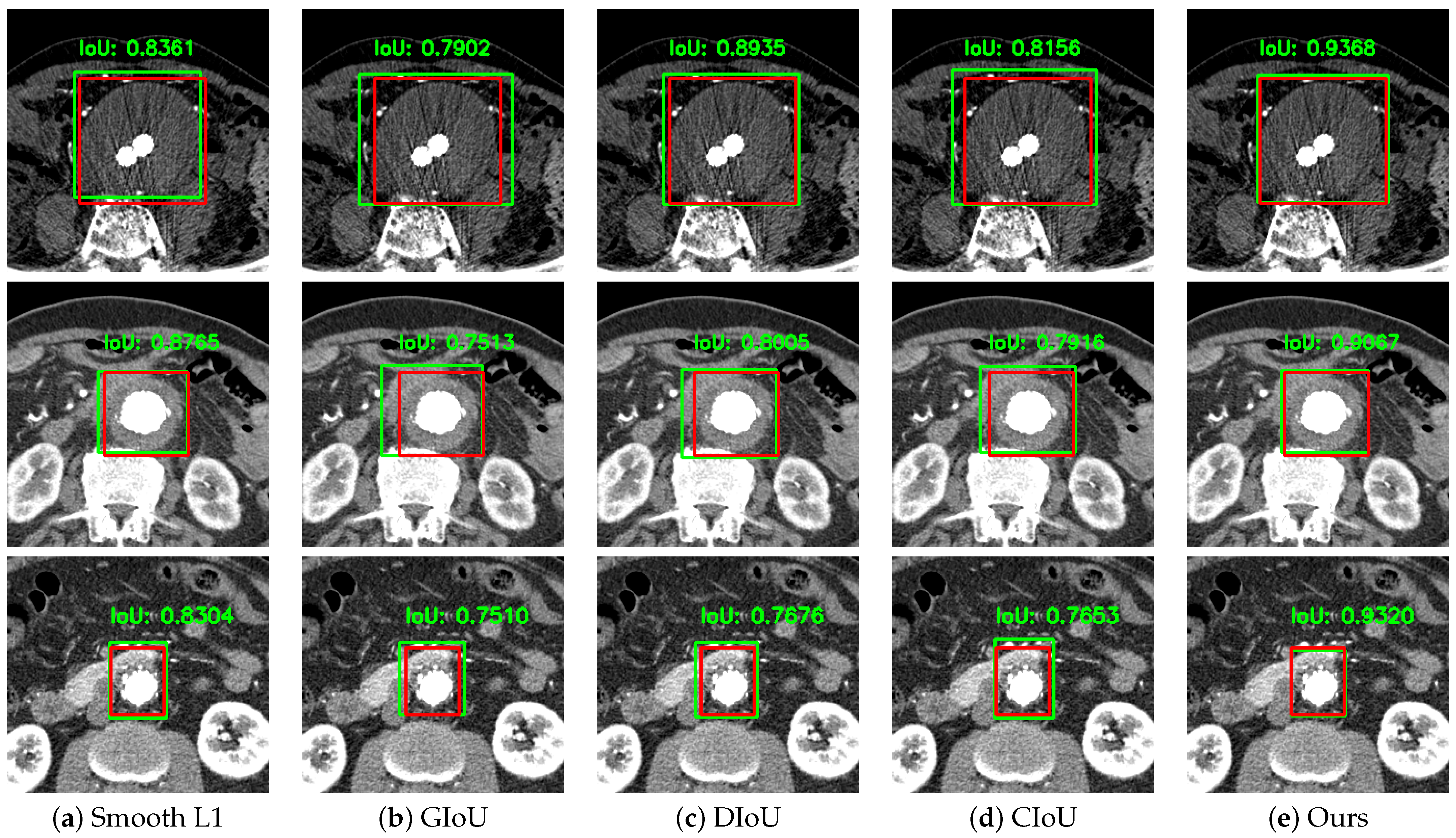 Sensors 22 03643 g004 550