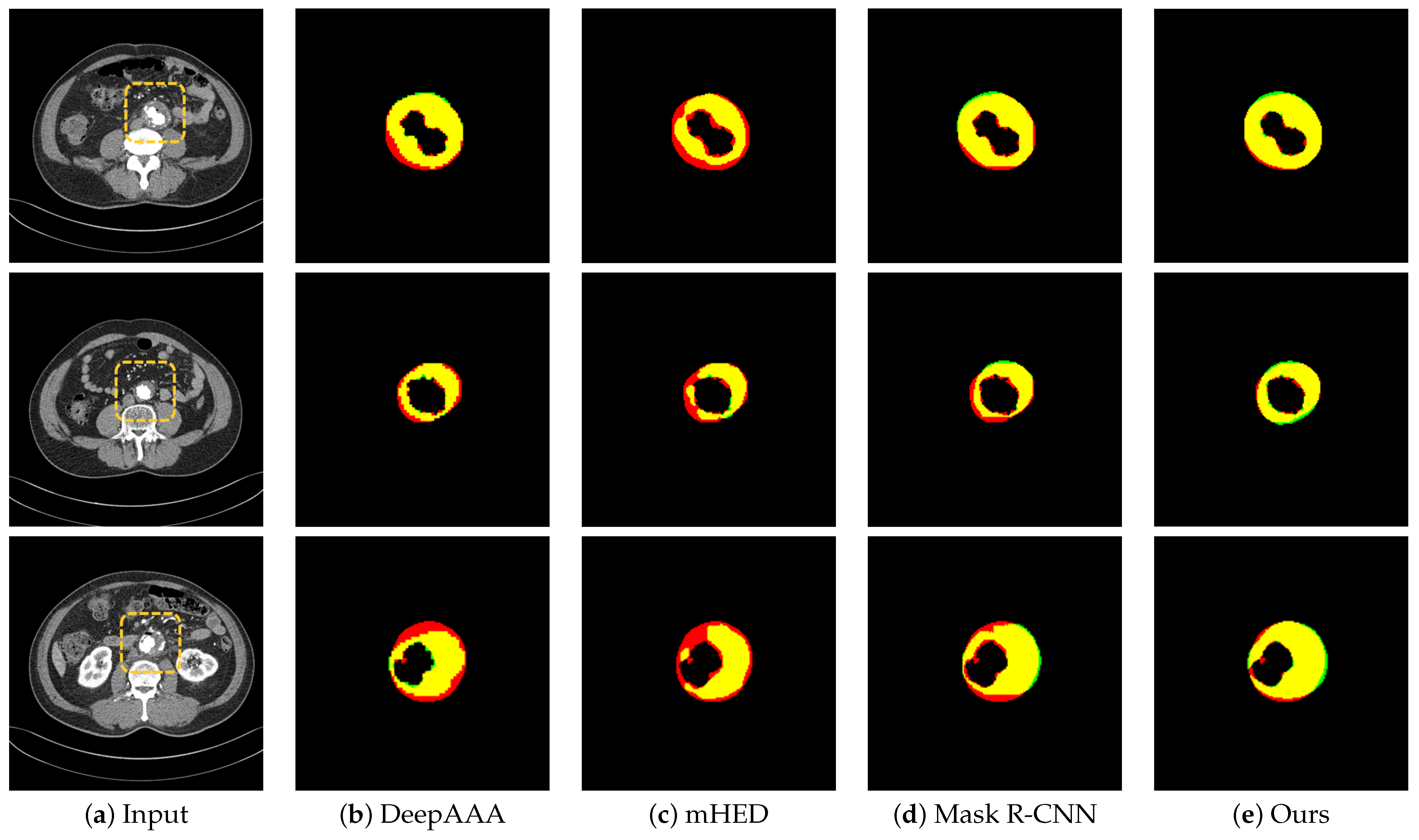 Sensors 22 03643 g005 550