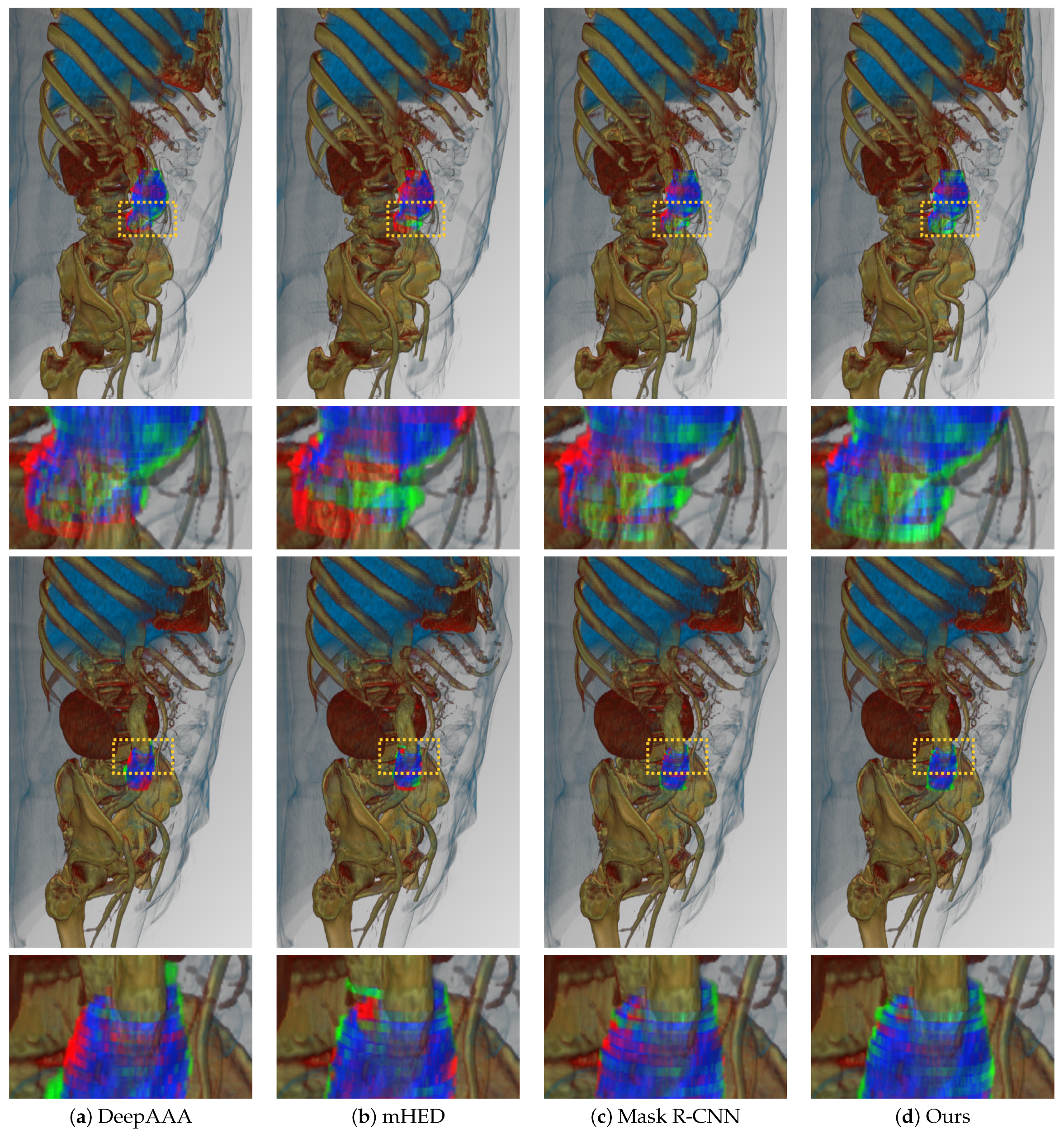 Sensors 22 03643 g006 550