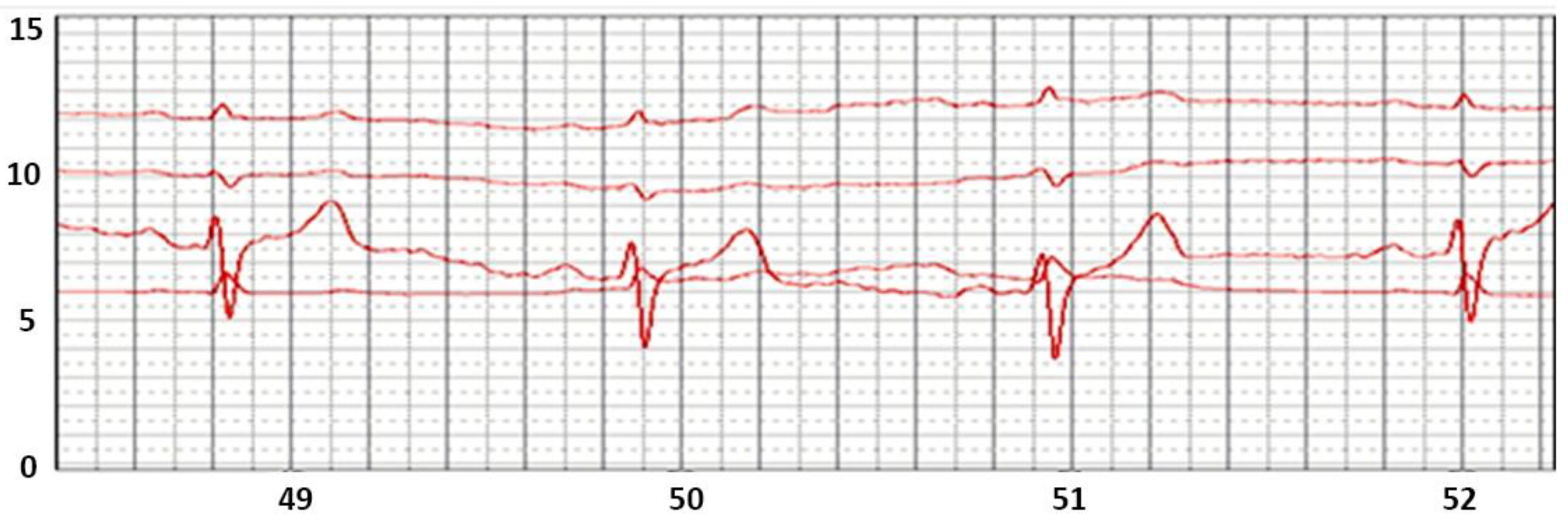 Sensors 22 03649 g004 550