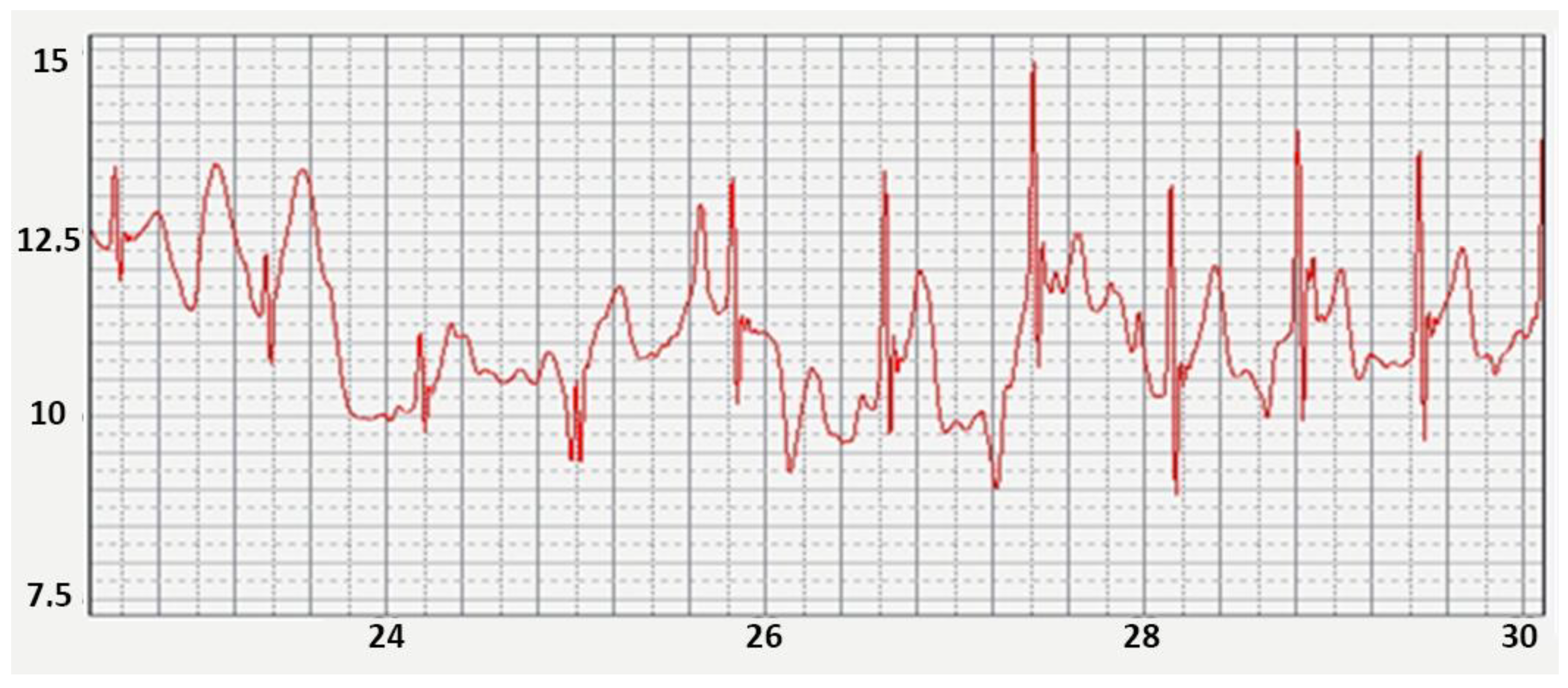Sensors 22 03649 g005 550