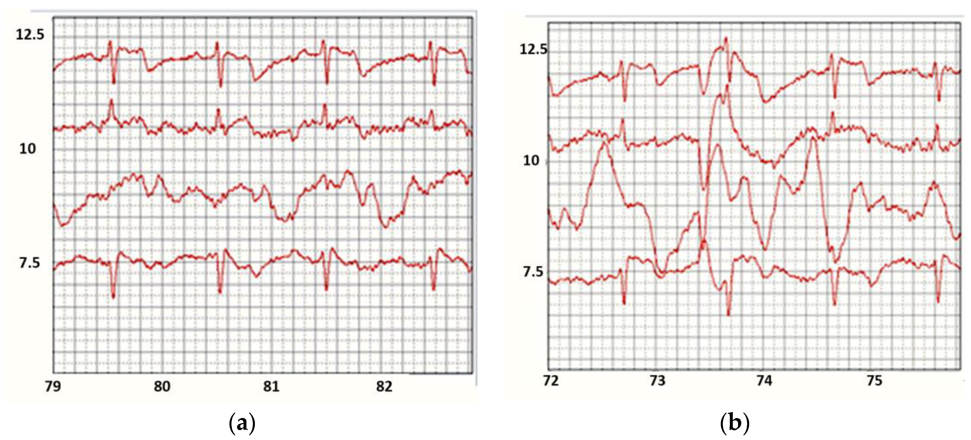 Sensors 22 03649 g009 550