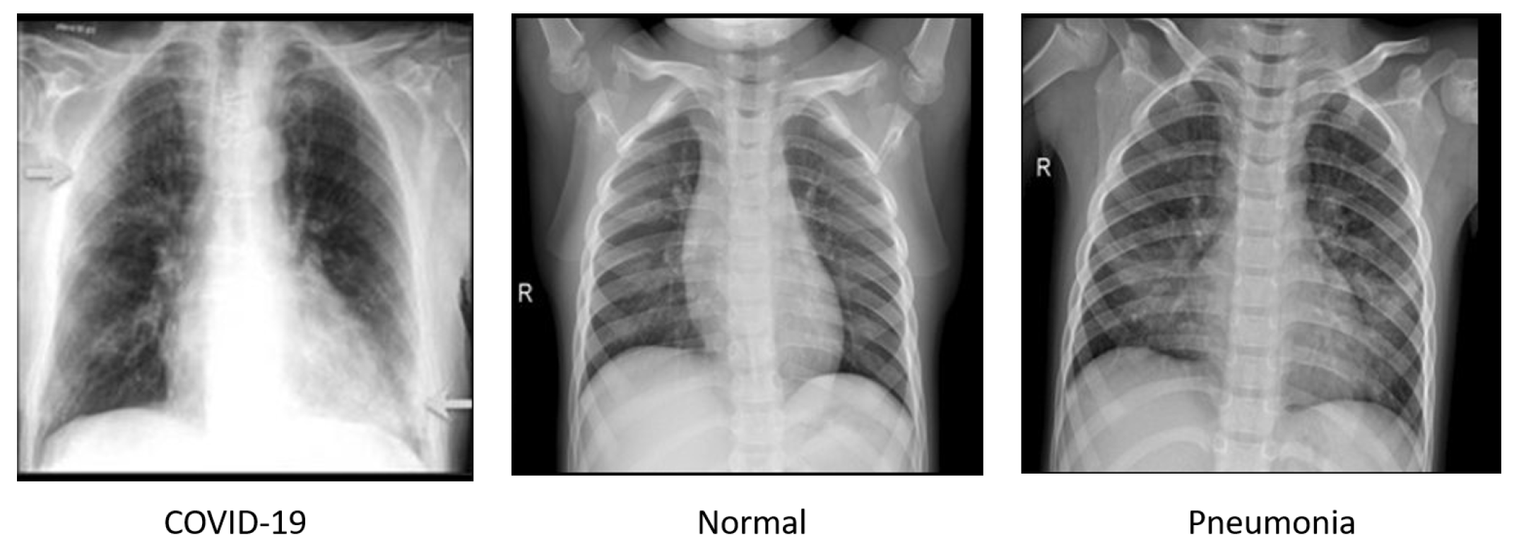 Sensors 22 03728 g006