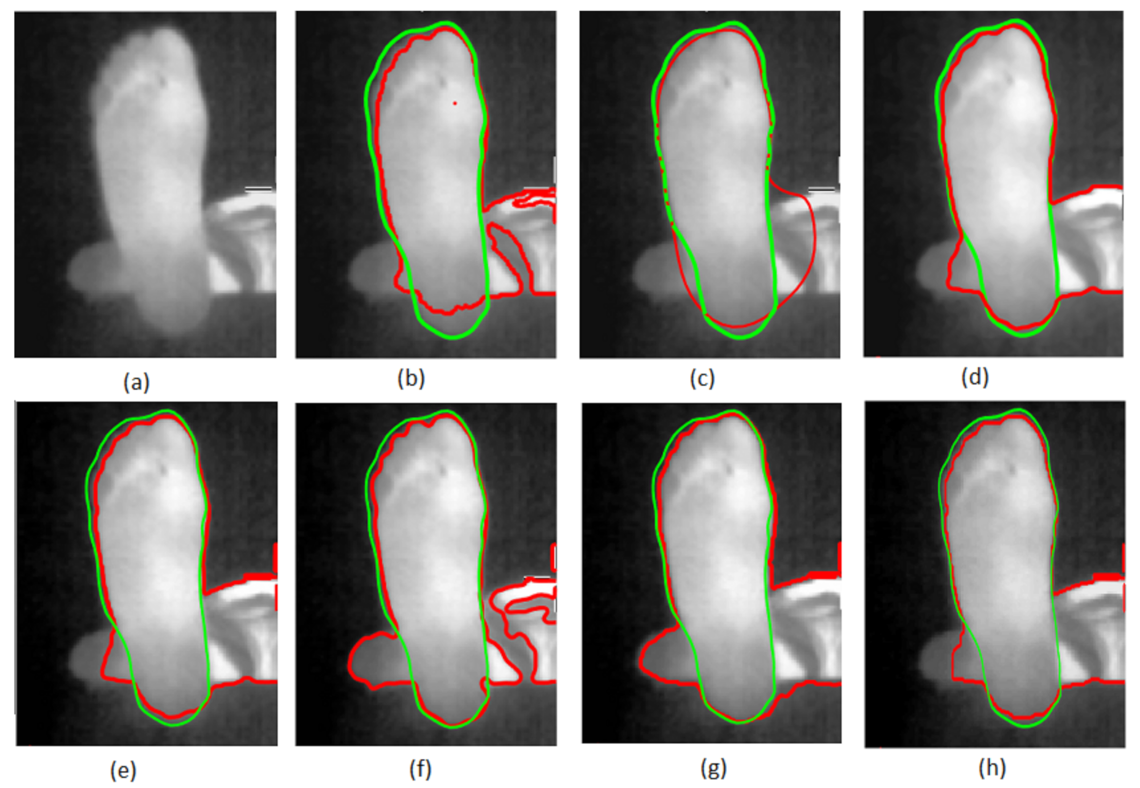 Sensors 22 03835 g004 550