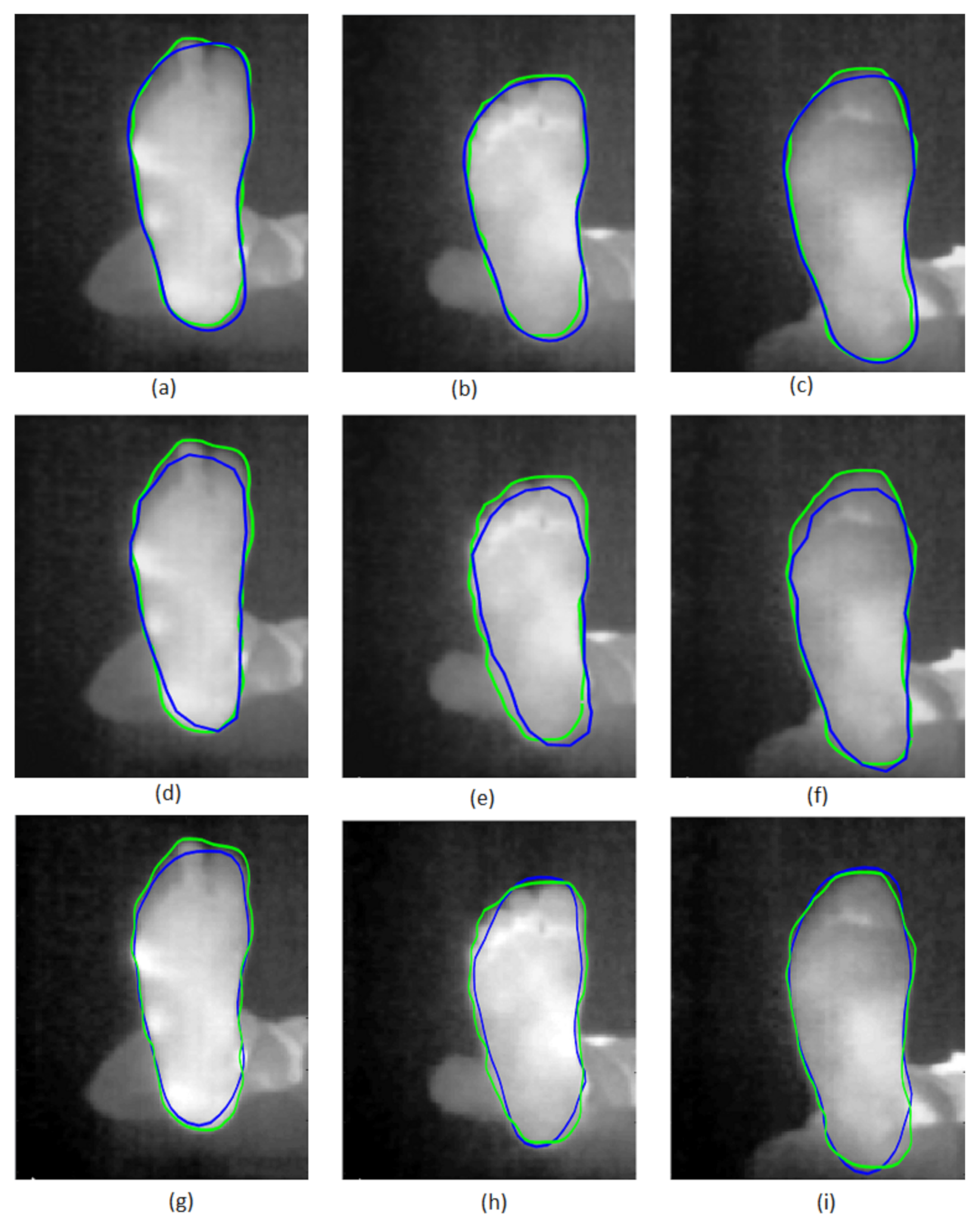 Sensors Free FullText Segmentation of Plantar Foot Thermal Images