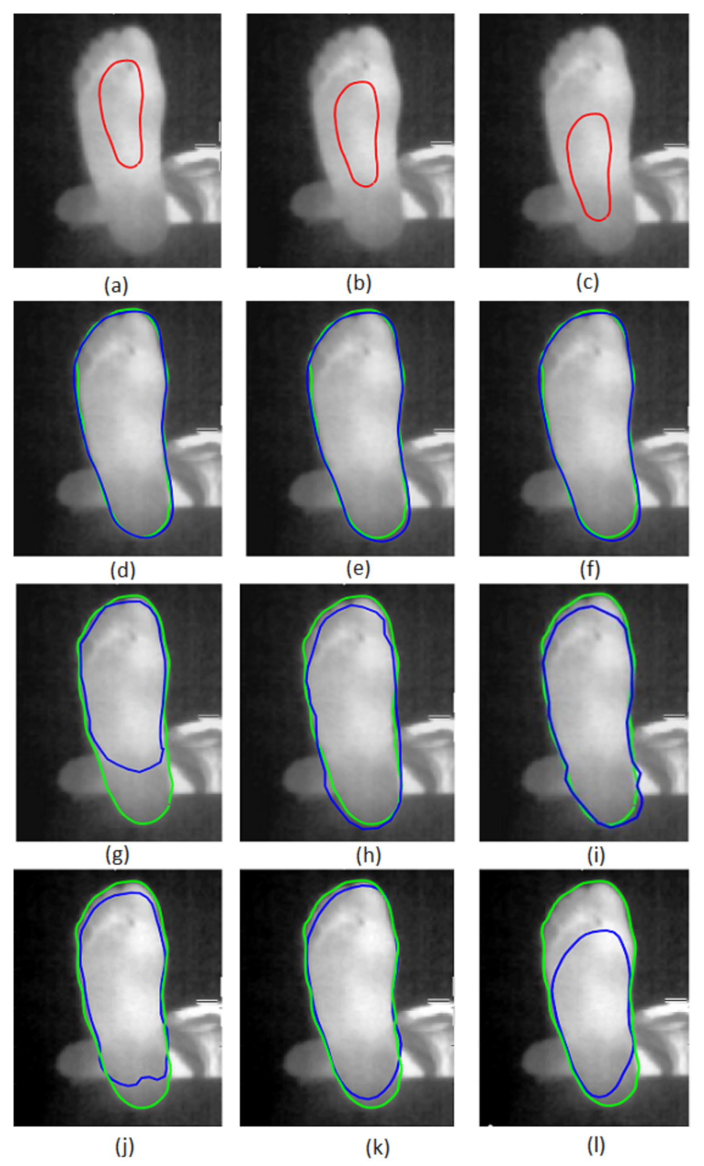 Sensors 22 03835 g007 550