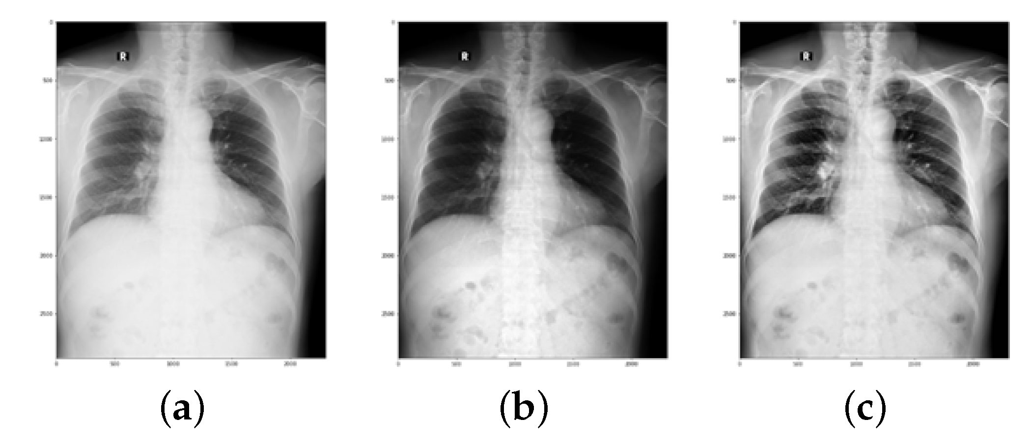 Sensors 22 03846 g008