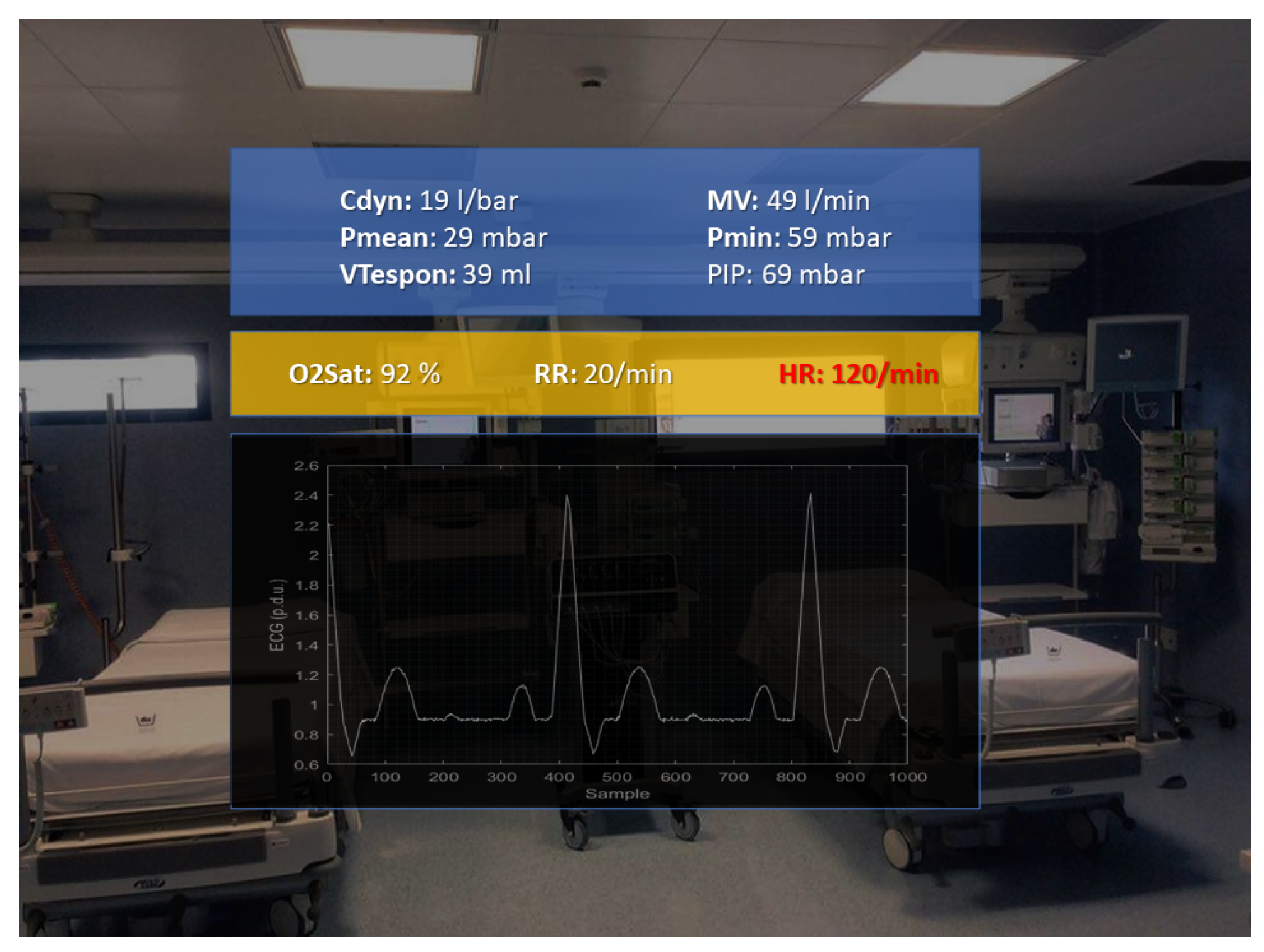 Sensors 22 03908 g007