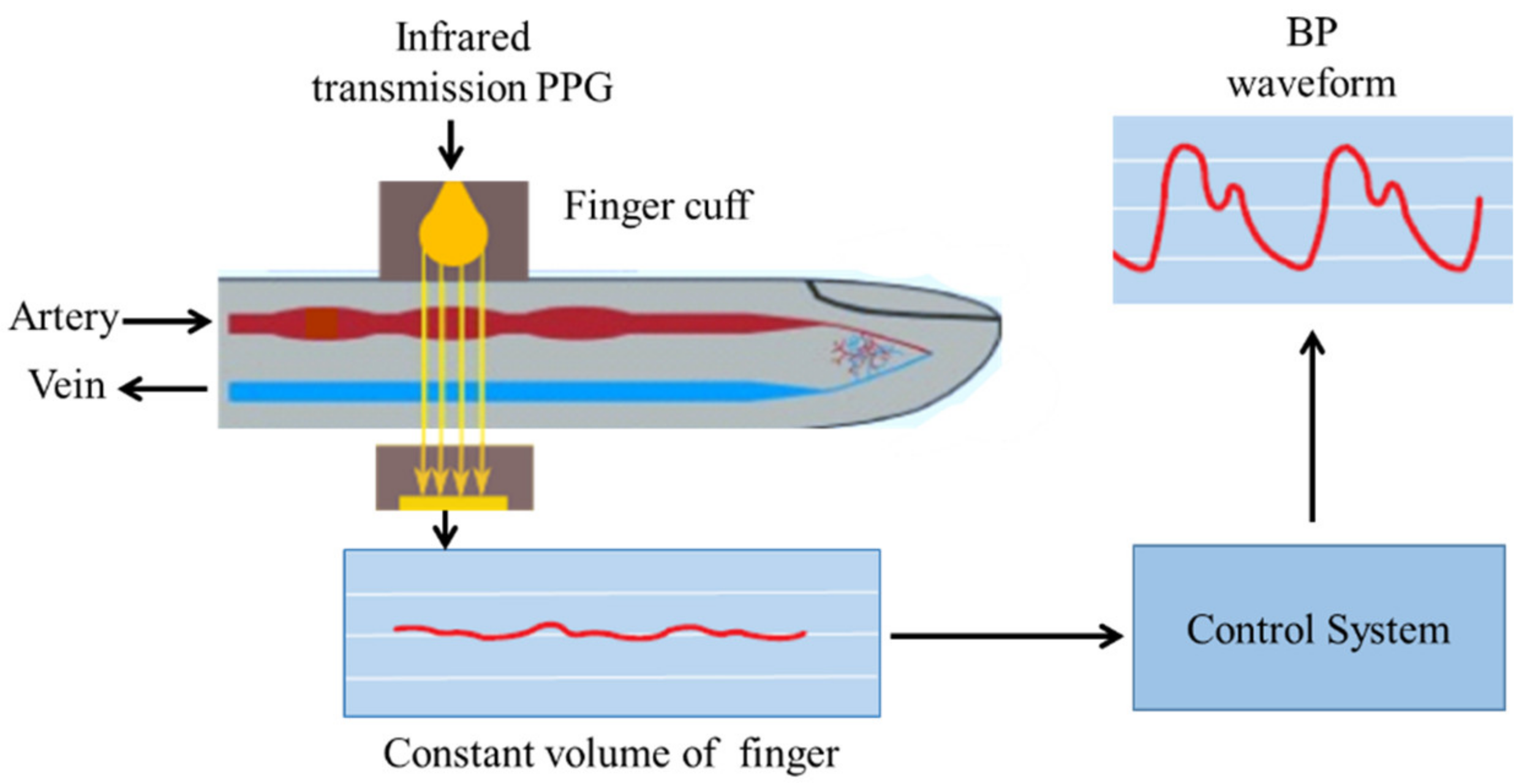 Non-invasive continuous blood pressure monitoring: a review of current  applications