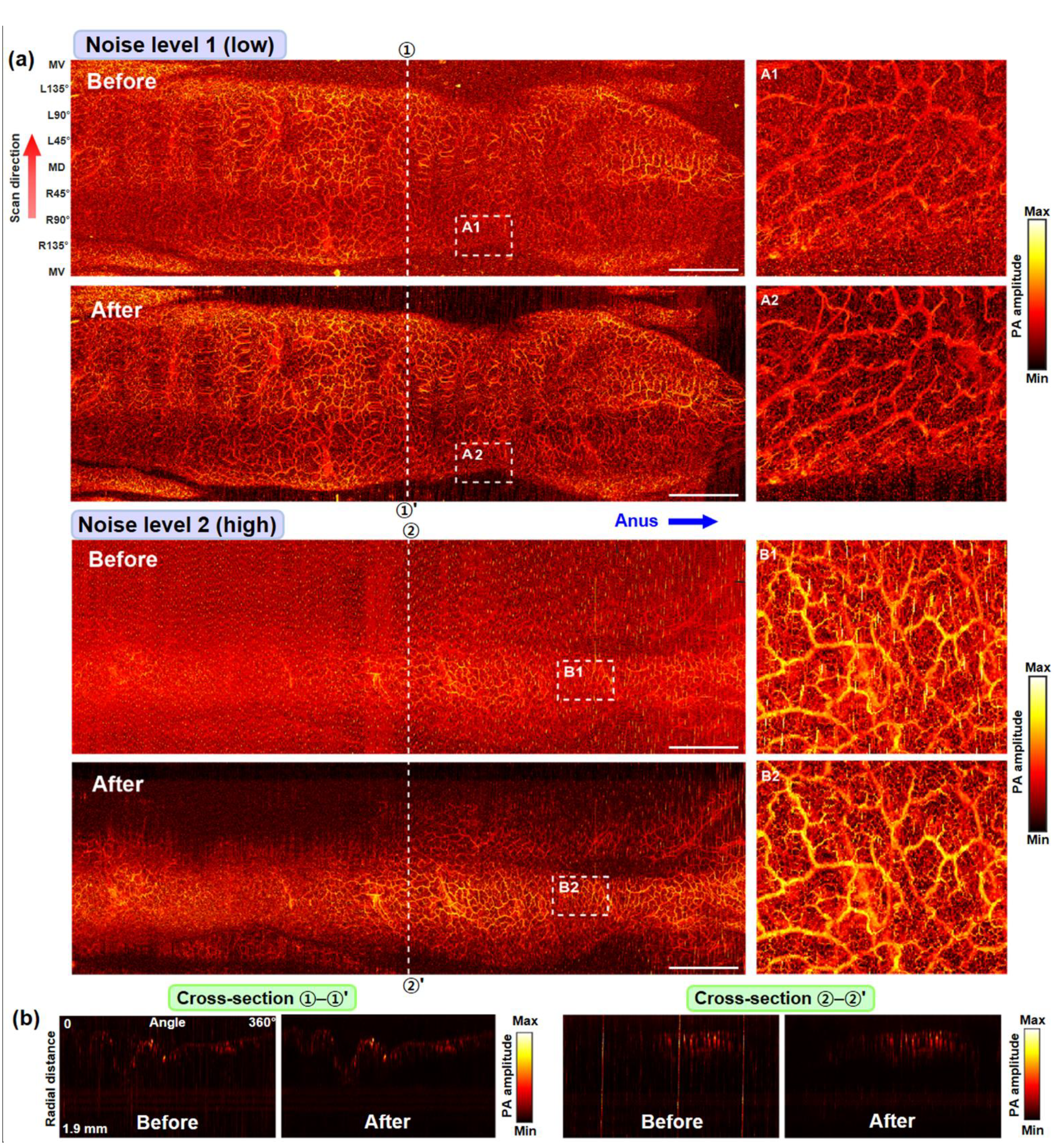 Sensors 22 03961 g005