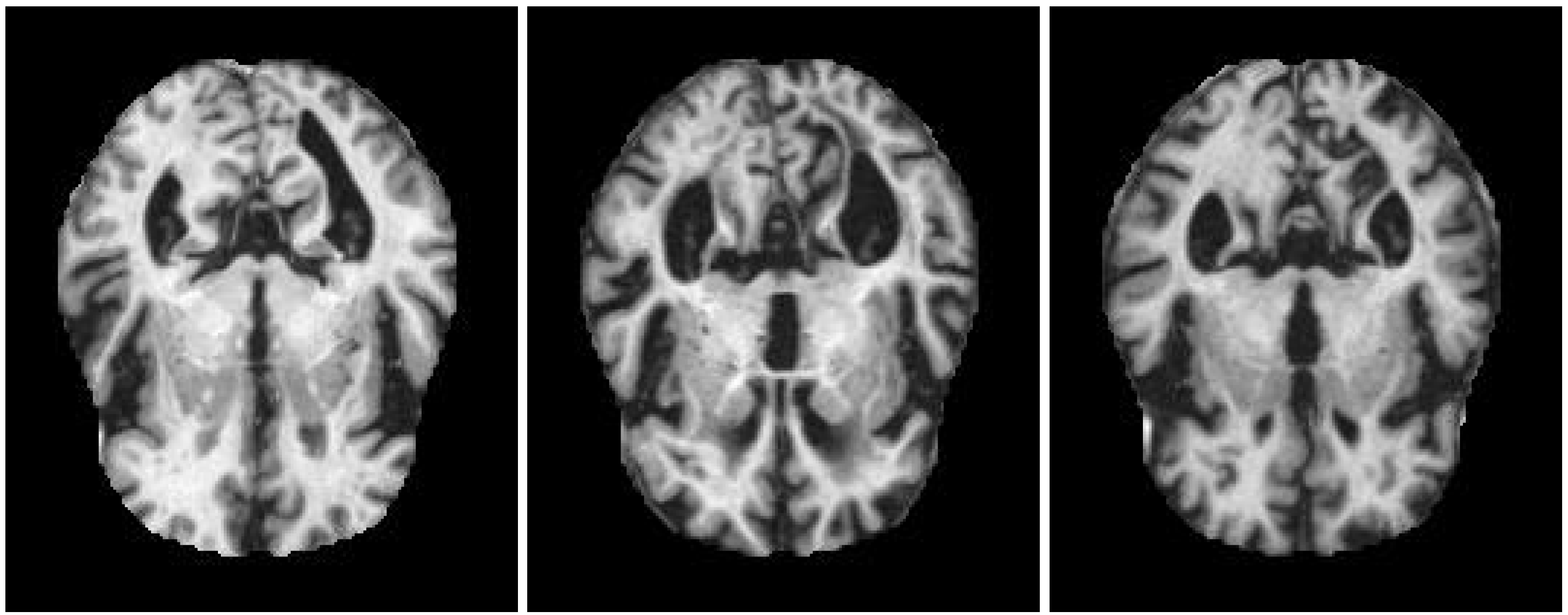 Sensors 22 03966 g002 550