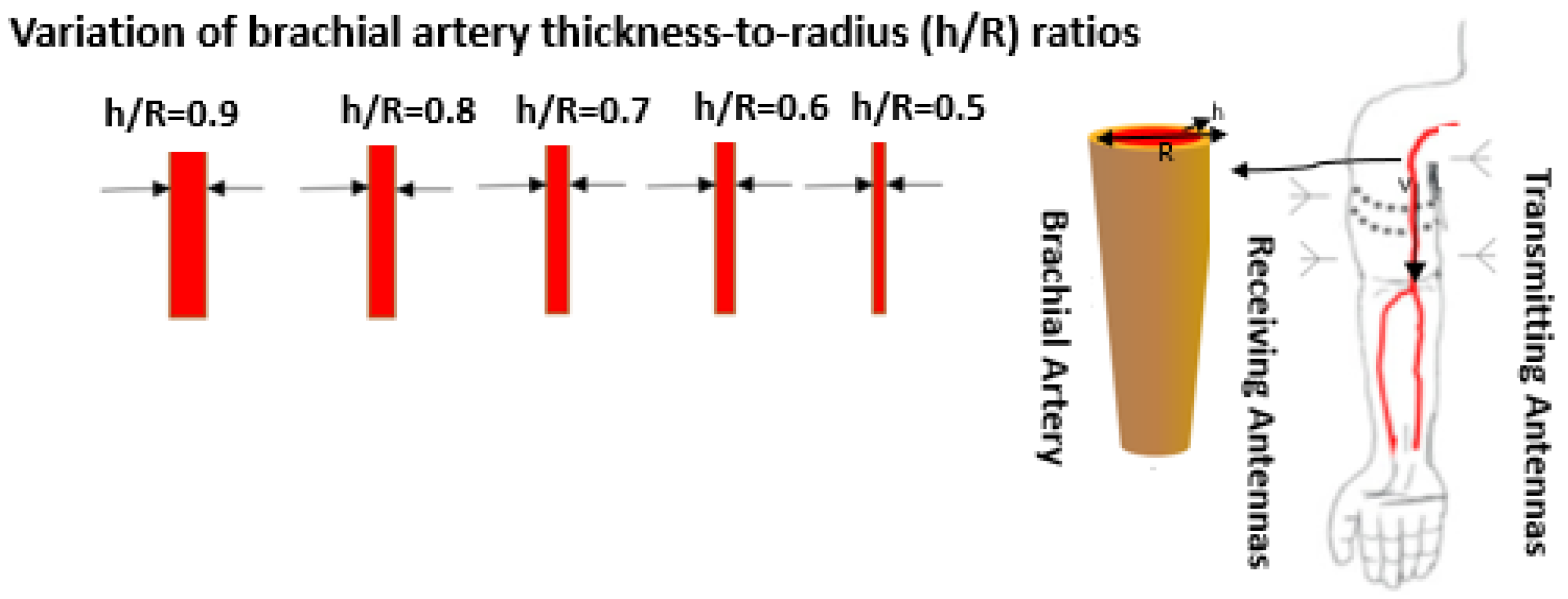 Sensors Free FullText Wearable Blood Pressure Sensing Based on
