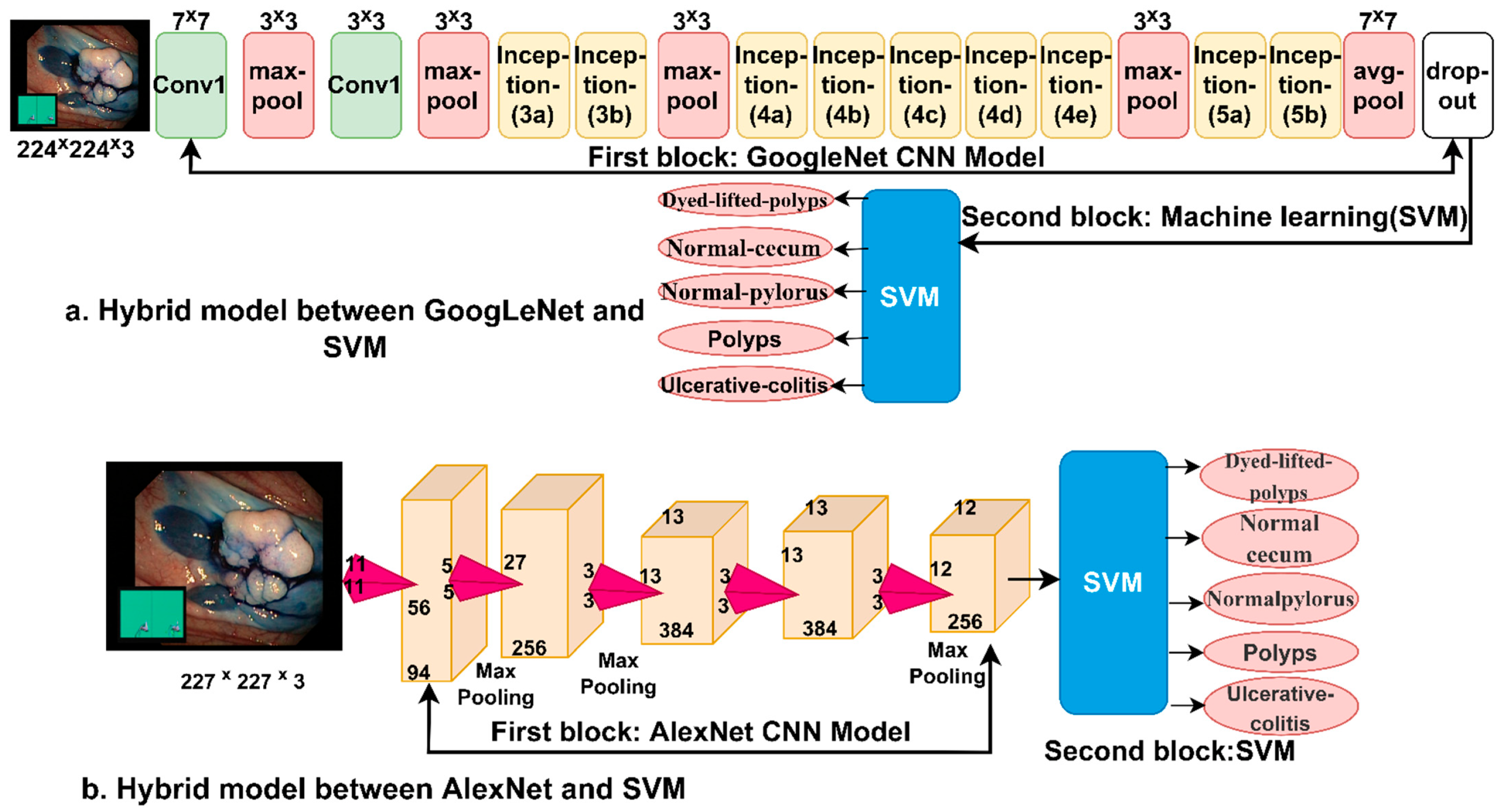 Hybrid and Deep Learning Approach for Early Diagnosis of Lower ...