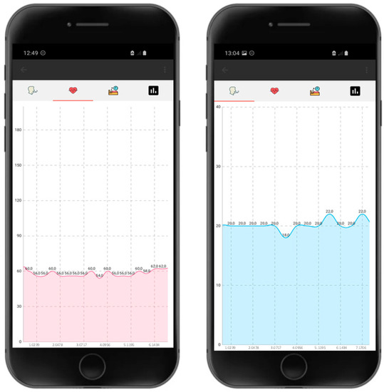 How to Metatrader 4 white background iPhone step by step