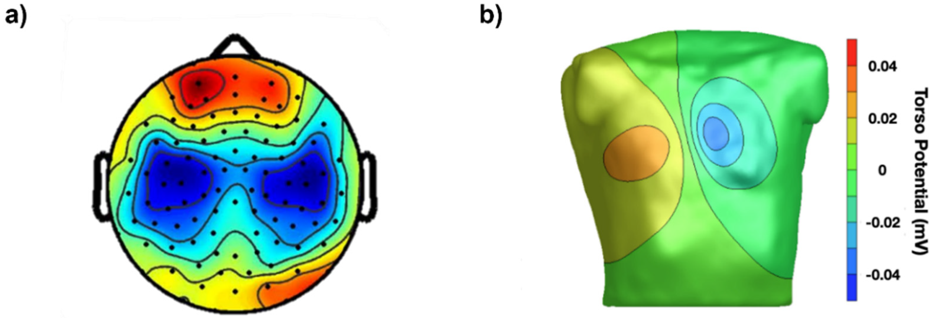 Sensors 22 04150 g001 550