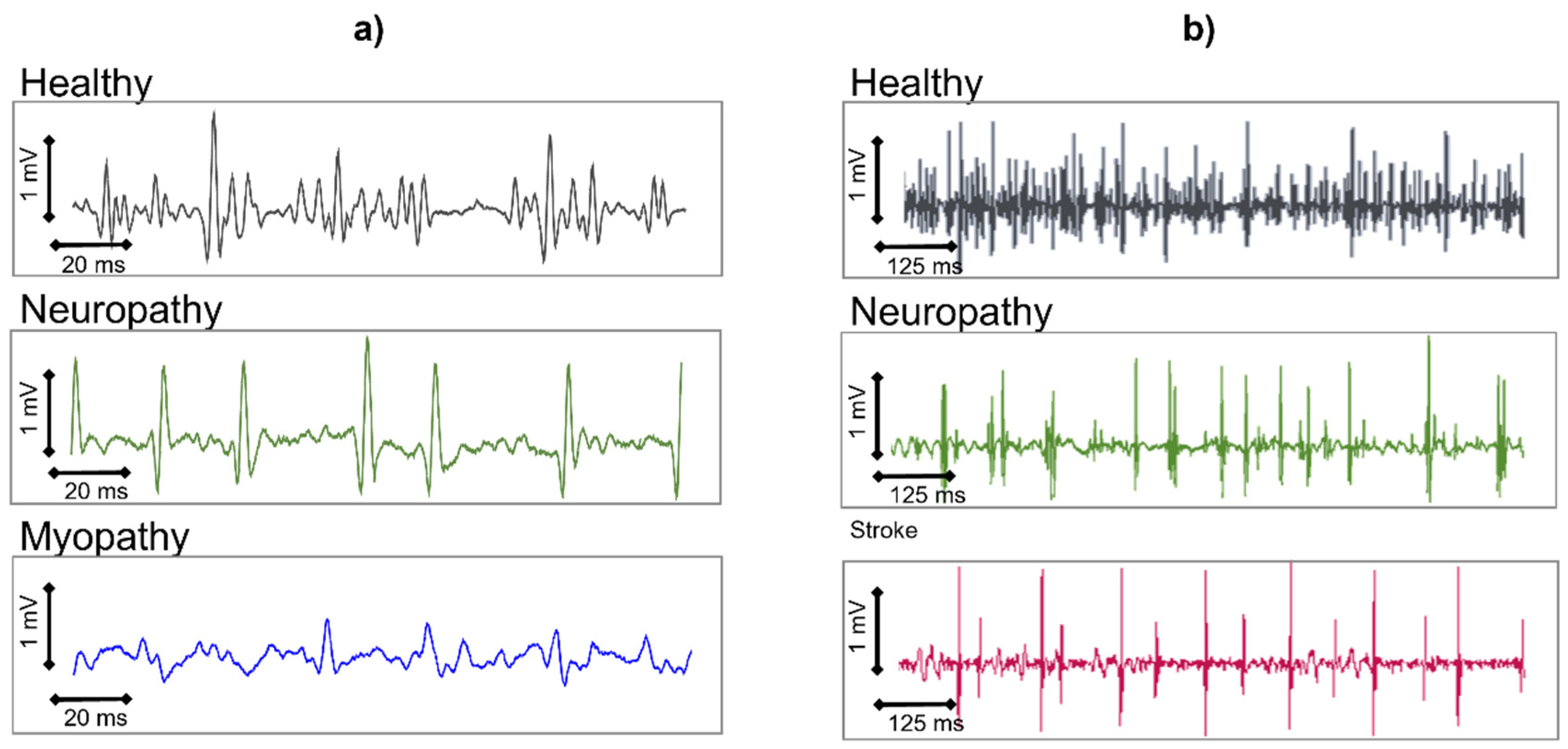 Sensors 22 04150 g023 550