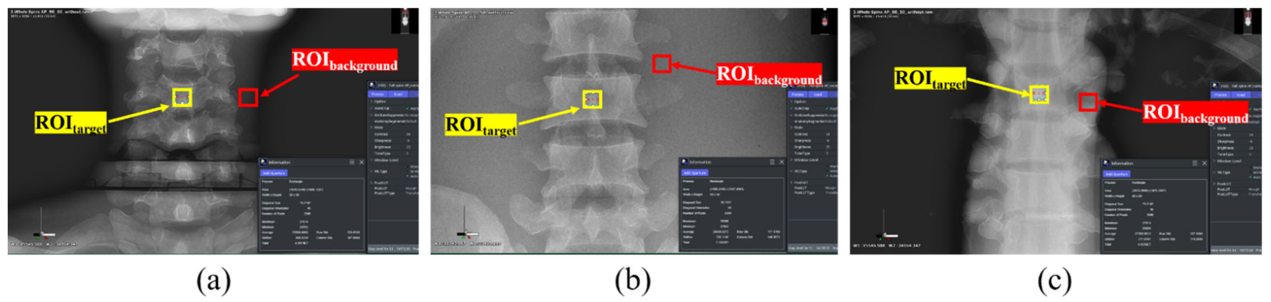 Sensors 22 04299 g003 550