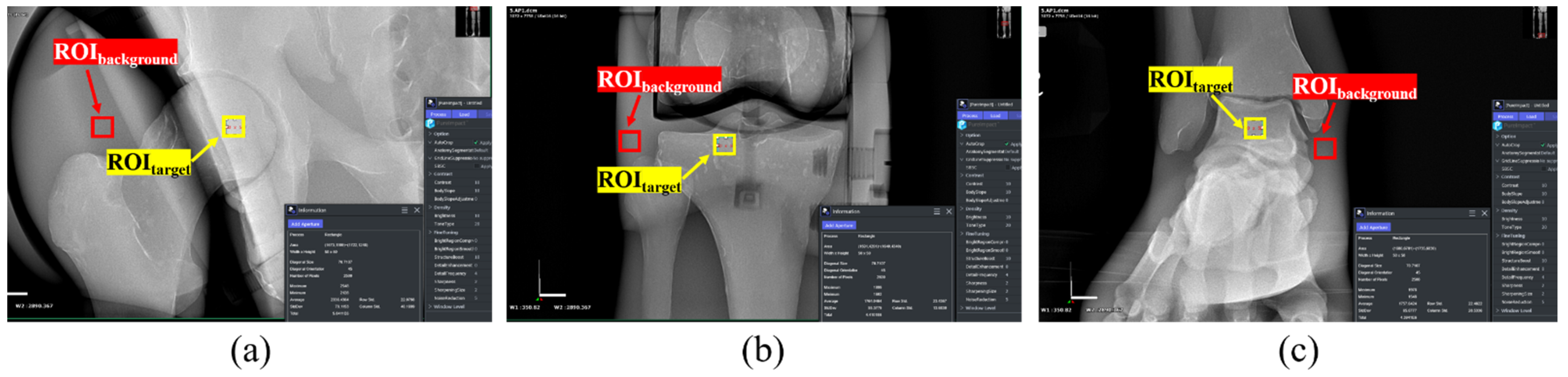 Sensors 22 04299 g005 550