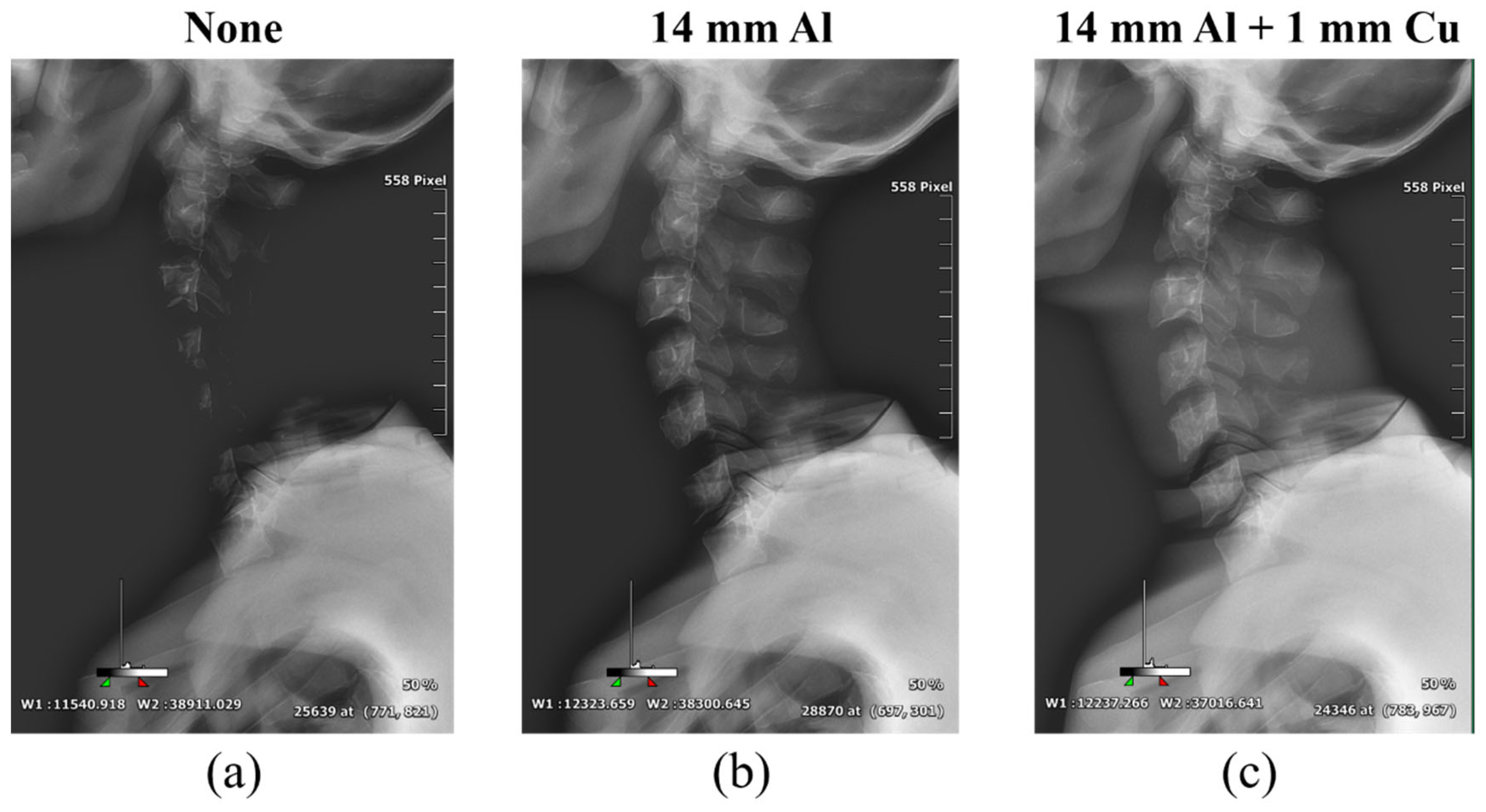 Sensors 22 04299 g007 550