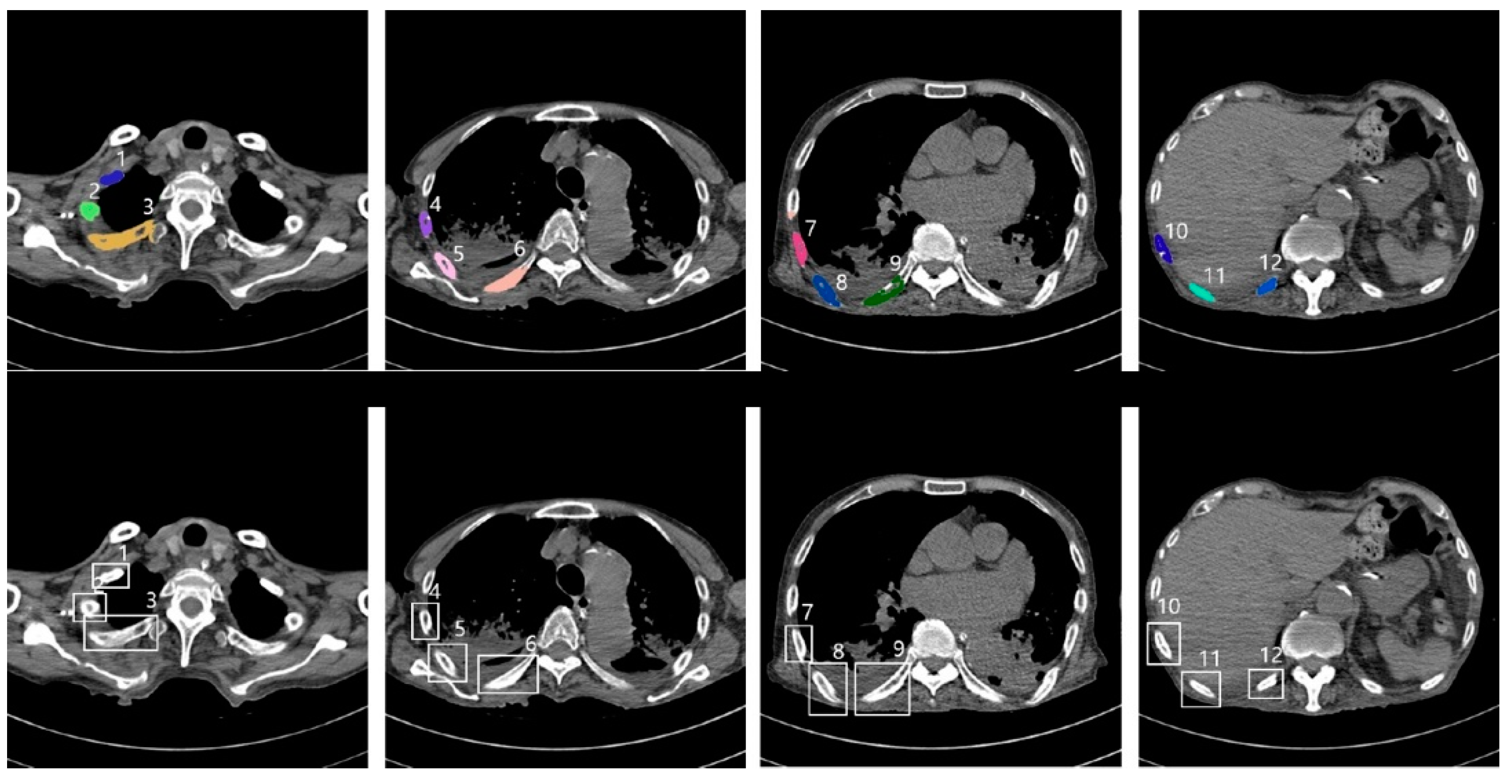 Sensors 22 04530 g005 550