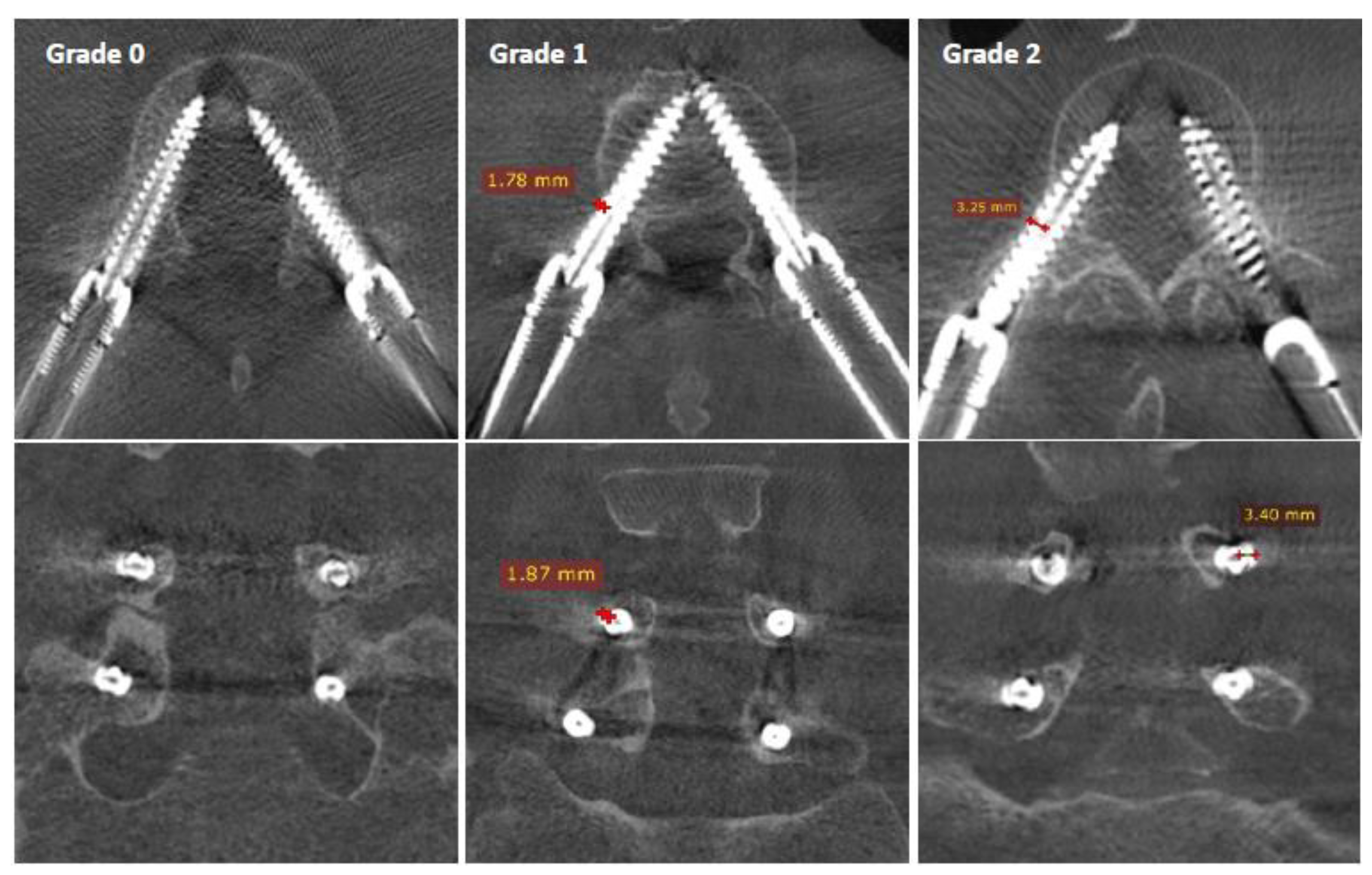 Sensors 22 04615 g003 550