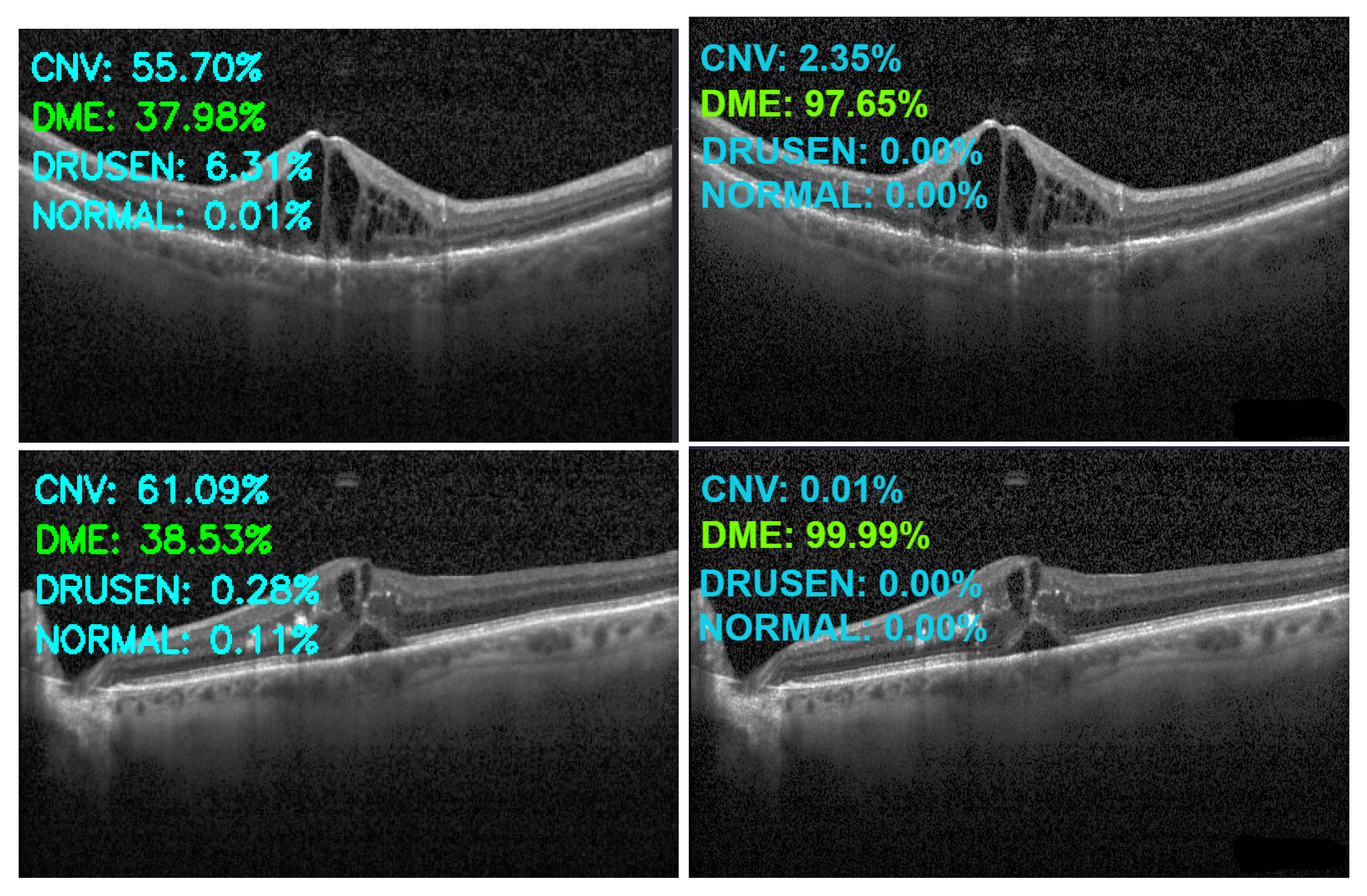 Sensors 22 04675 g014 550