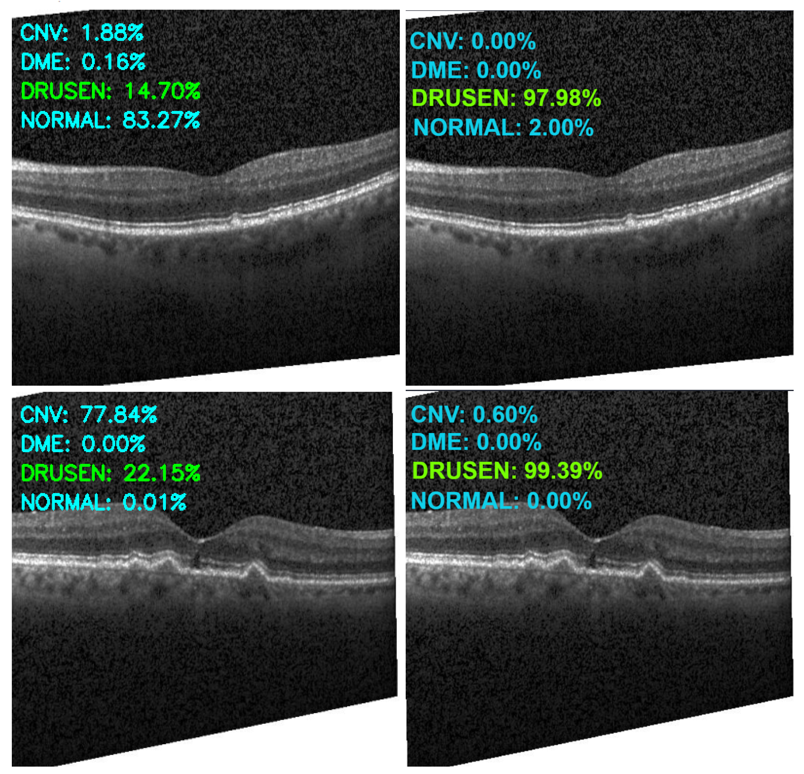 Sensors 22 04675 g015 550