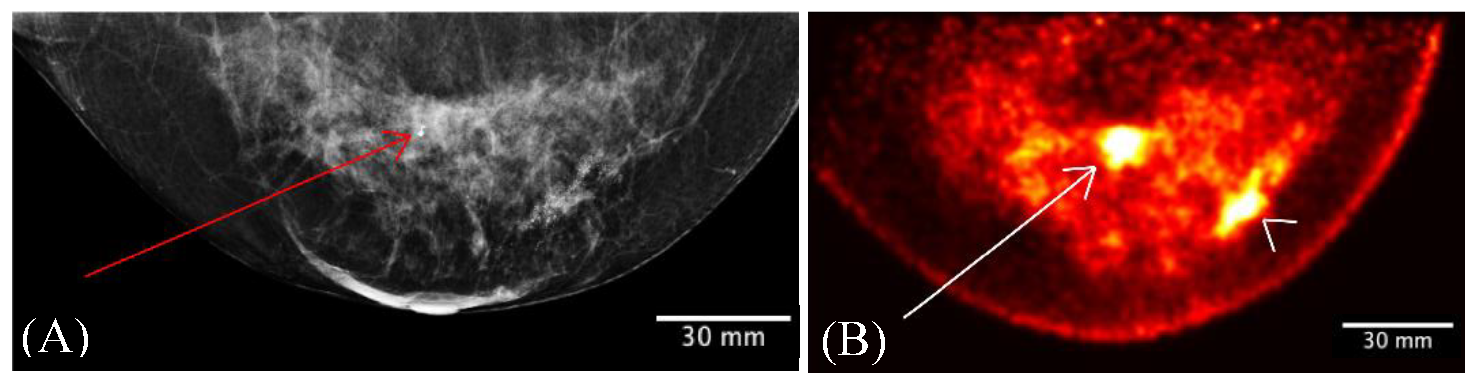 Sensors 22 04678 g010 Sensors 22 04678 g010