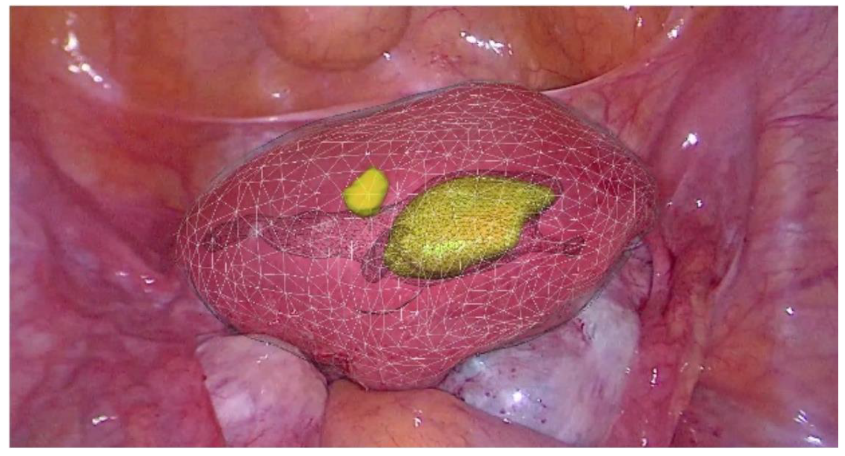 Sensors 22 04918 g007