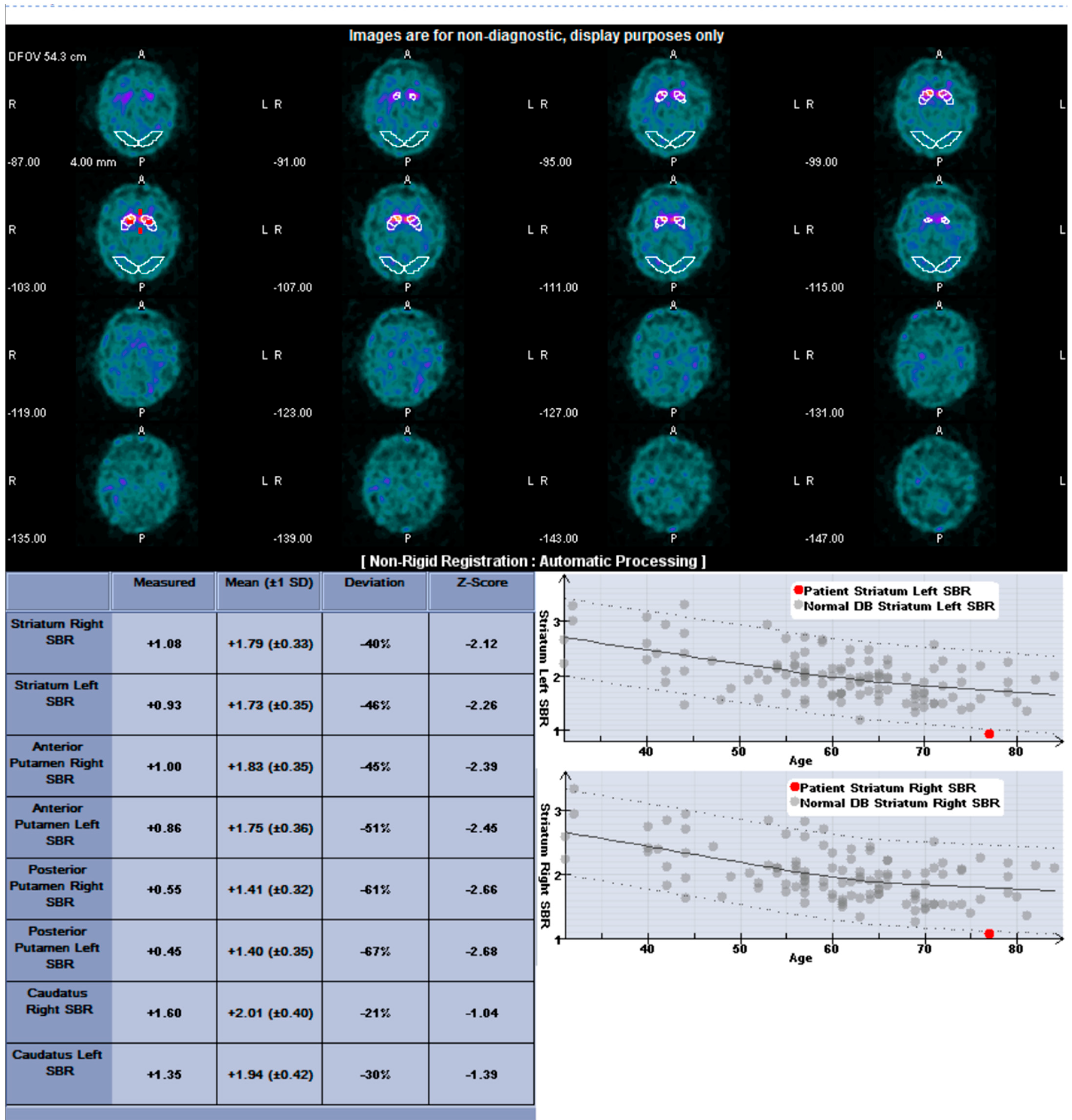 Sensors 22 05055 g003
