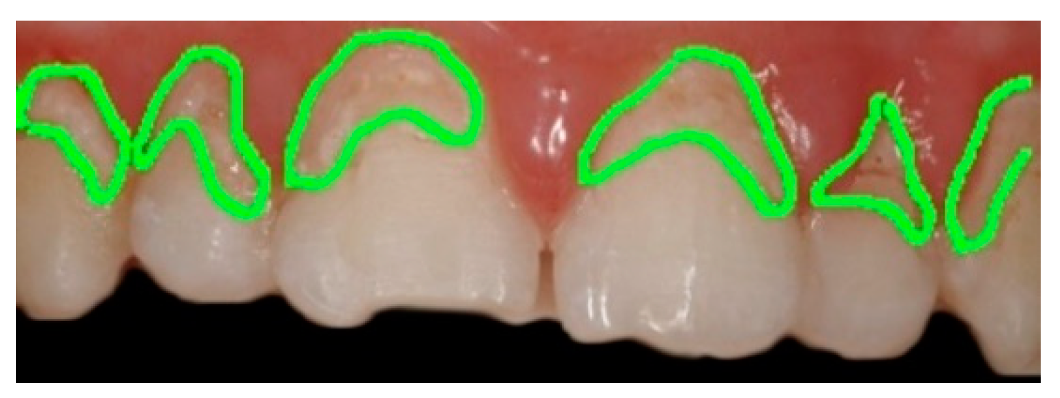 Sensors 22 05133 g008 550