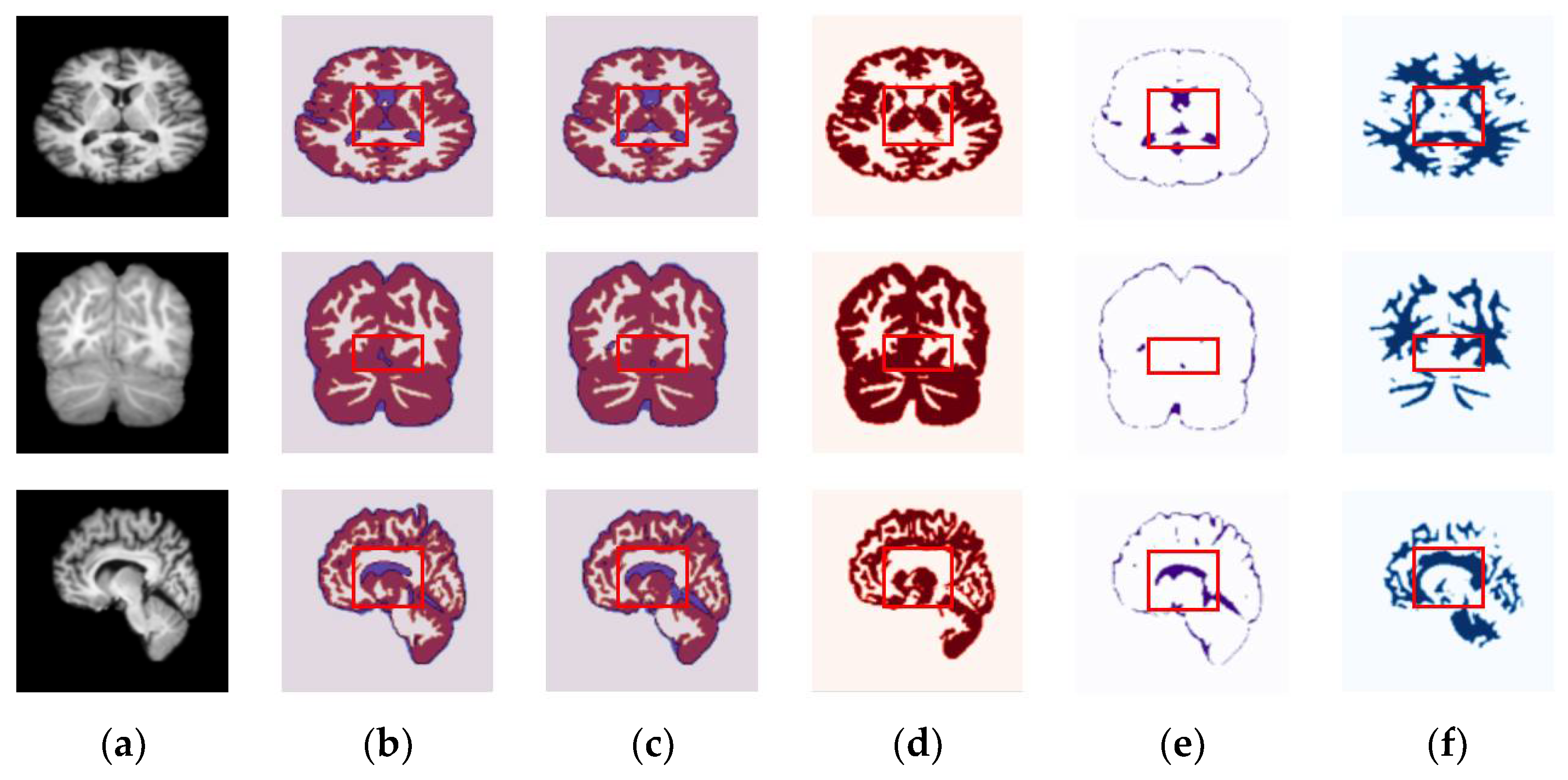 Sensors 22 05148 g005