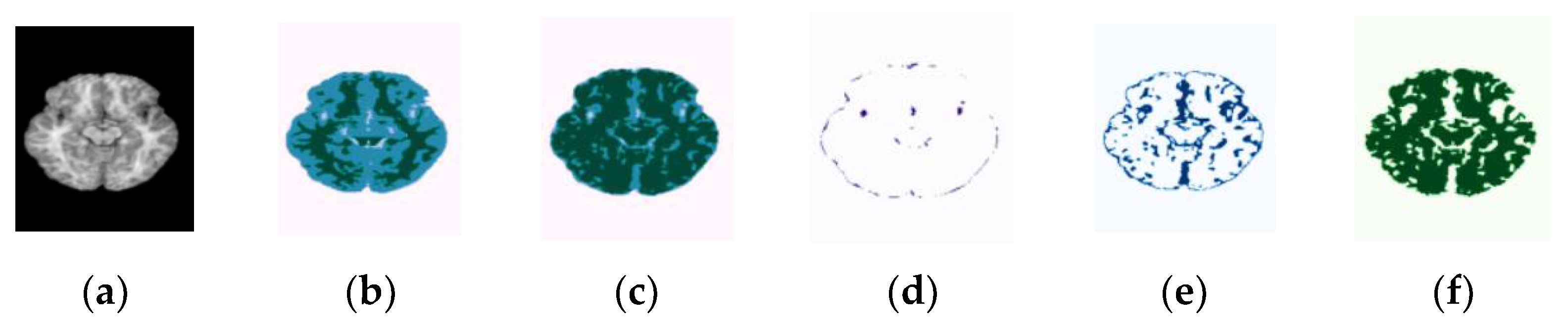 Sensors 22 05148 g011