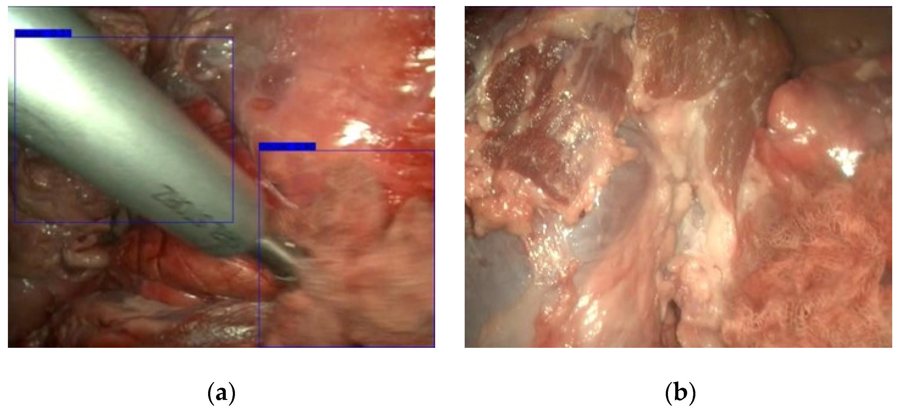 Sensors 22 05180 g006