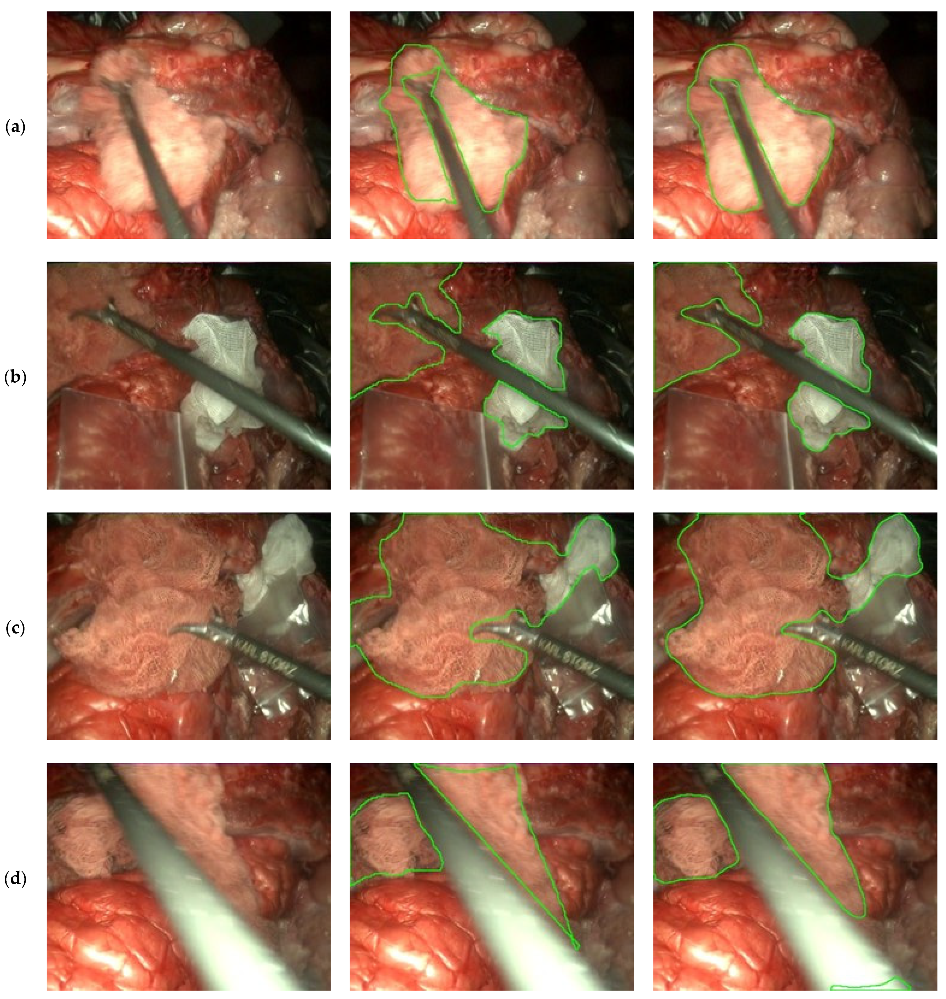 Sensors 22 05180 g008