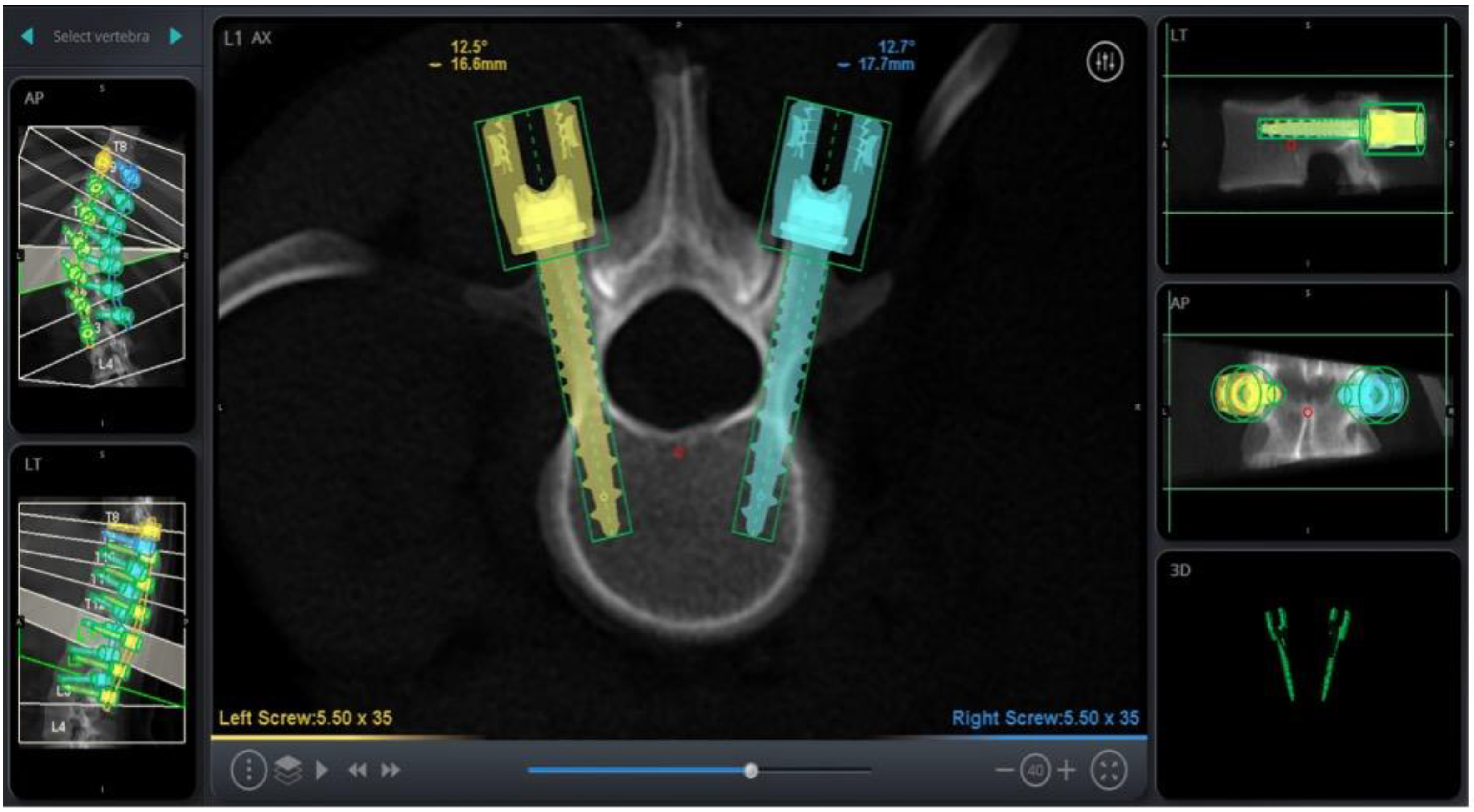 Sensors 22 05204 g001 550